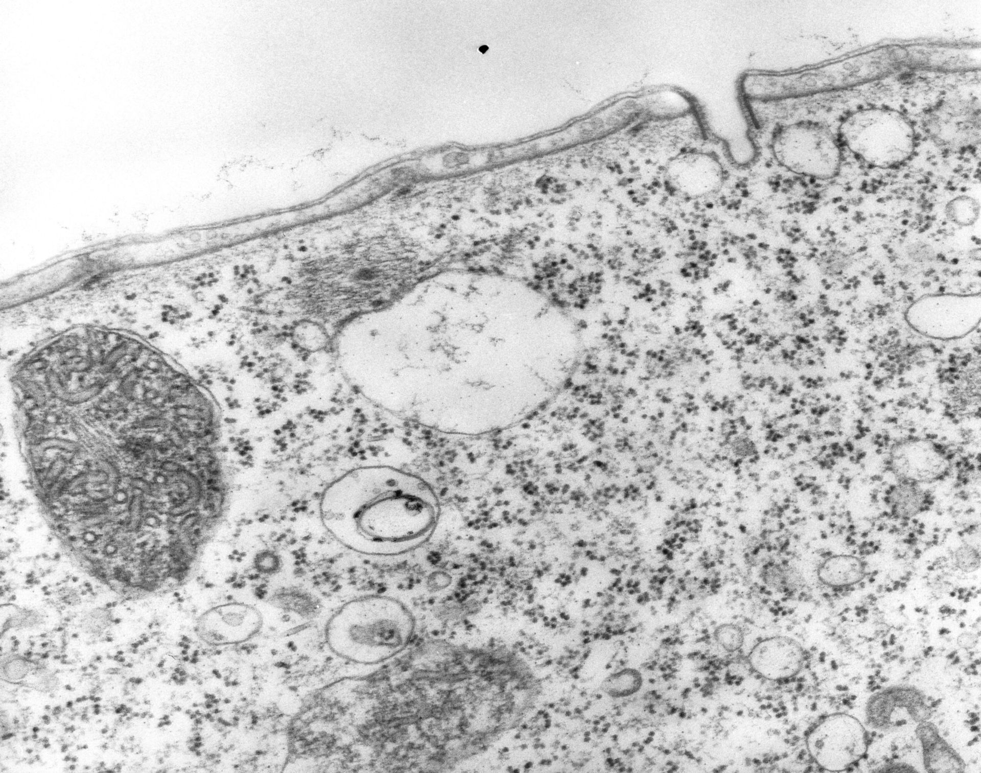 Vorticella convallaria (Rough endoplasmic reticulum membrane) - CIL:39324
