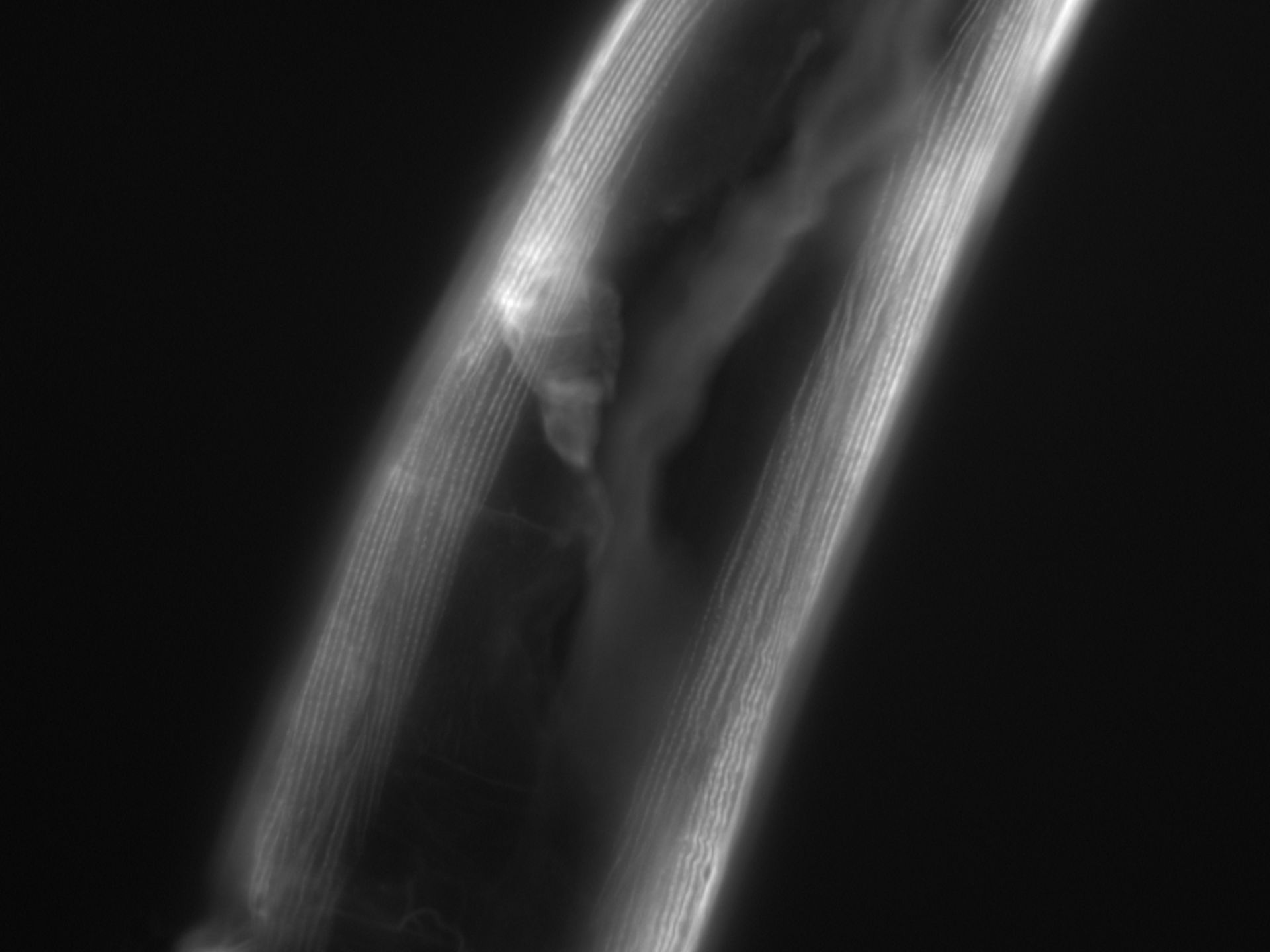 Caenorhabditis elegans (Actin filament) - CIL:1064