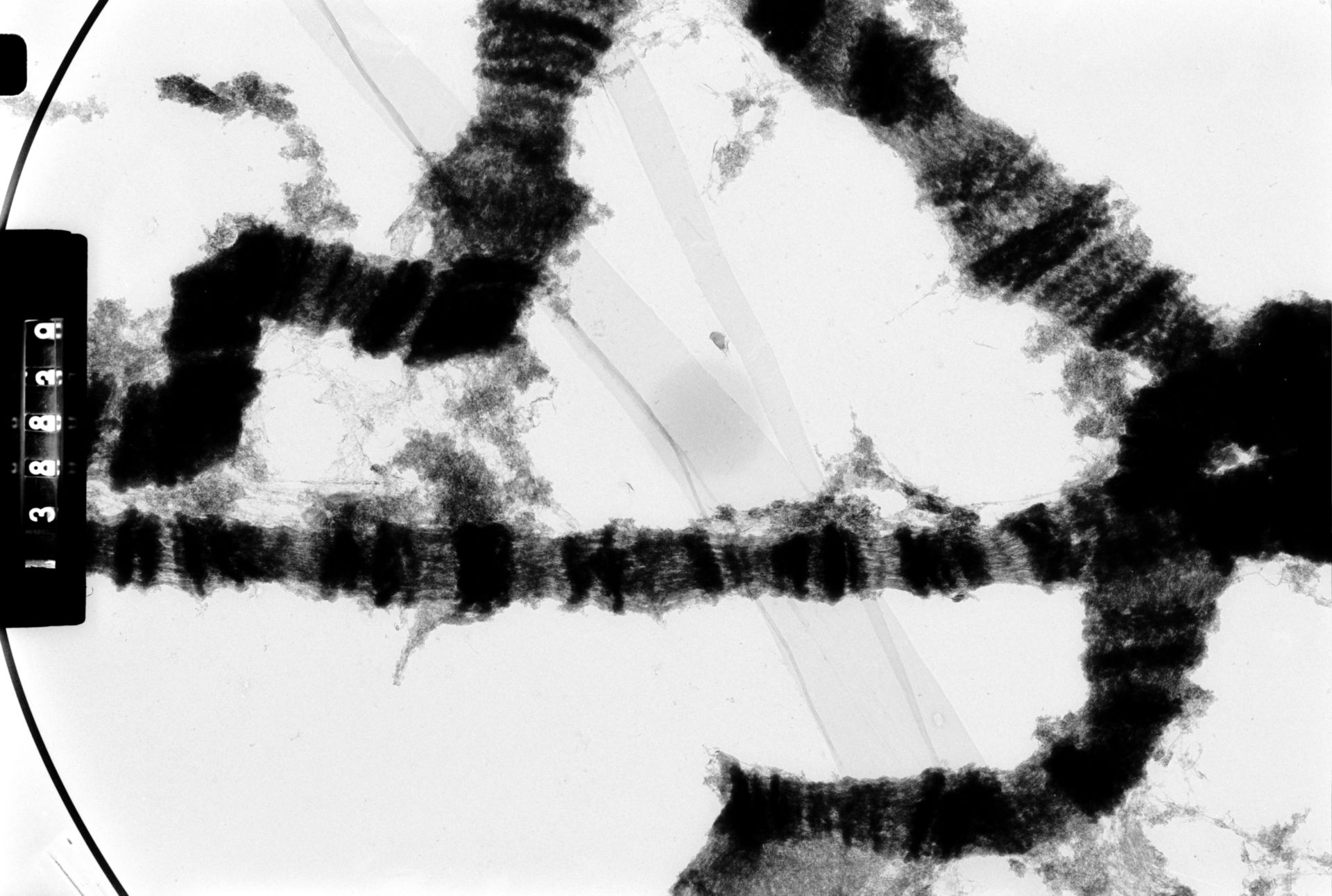 Drosophila melanocephala (Polytene chromosome) - CIL:35407