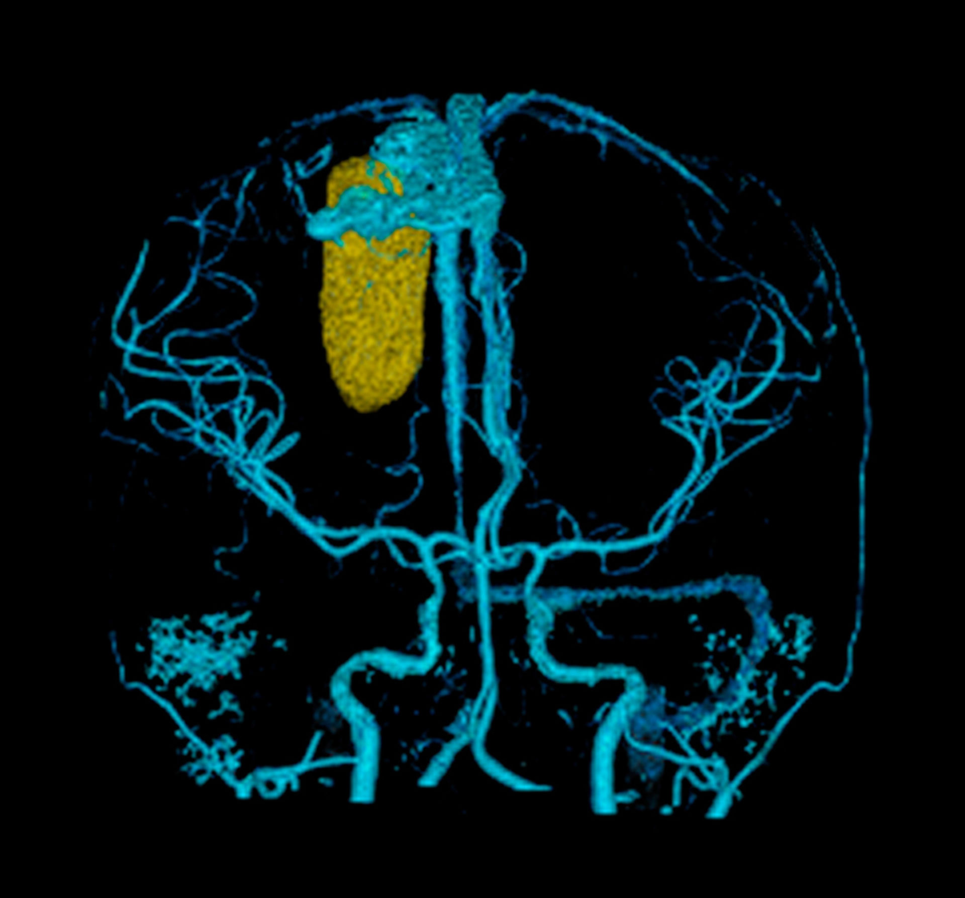 Third contest for computed tomography pictures – 
