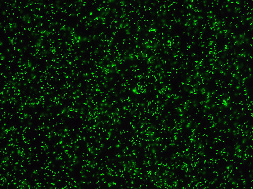 Leuchtende Keime: Unter dem Fluoreszenzmikroskop zeigen sich resistente Keime. © Gunther Jansen, CAU