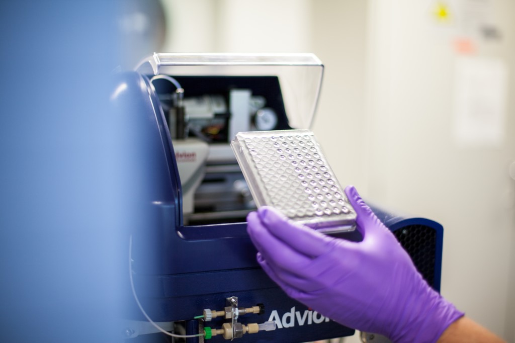 Mit einer Massenspektrometrie kann die Blutfettanalyse vorgenommen werden. © Stephan Wiegand / Medizinische Fakultät TU Dresden