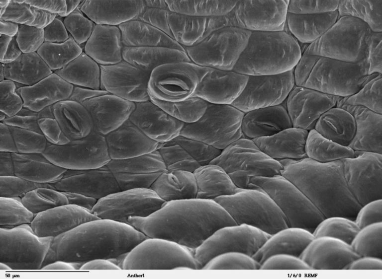 Plant leaf trichome (Hibiscus sp.), SEM - Stock Image - C037/0547 - Science  Photo Library