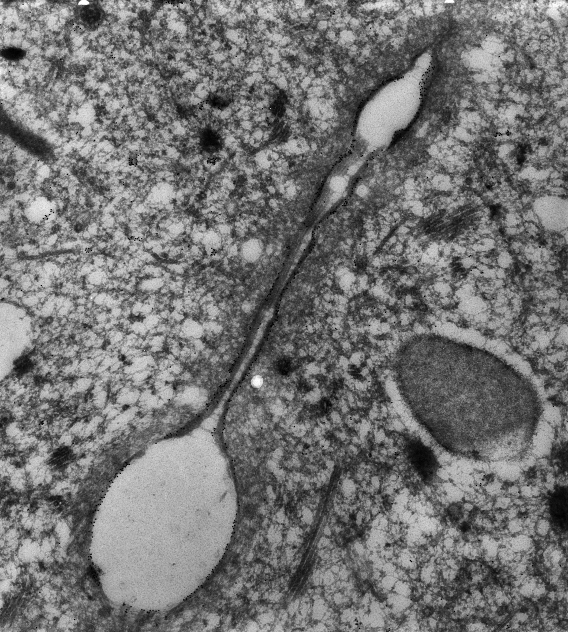 Paramecium tetraurelia (Cytoplasmic microtubule) - CIL:38690