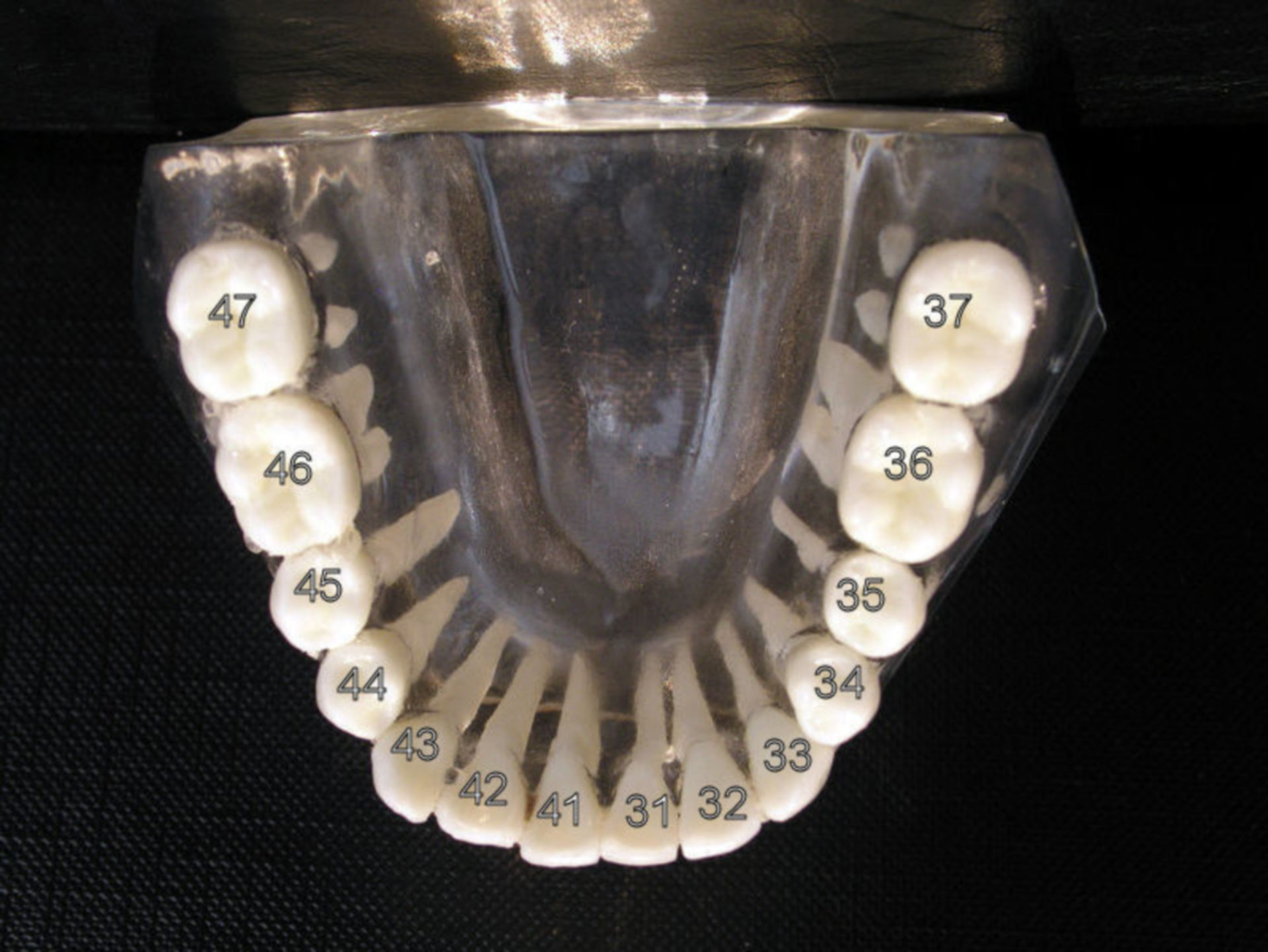 Zahnschema Unterkiefer
