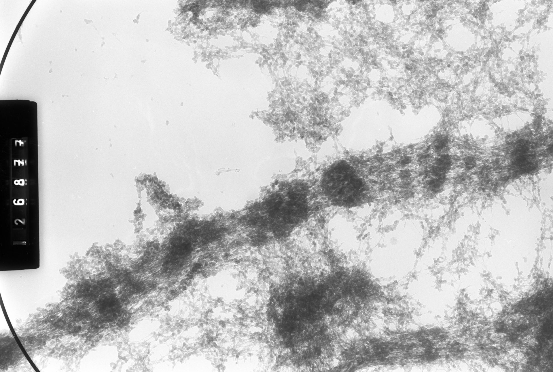 Drosophila melanogaster (Polytene chromosome) - CIL:25402