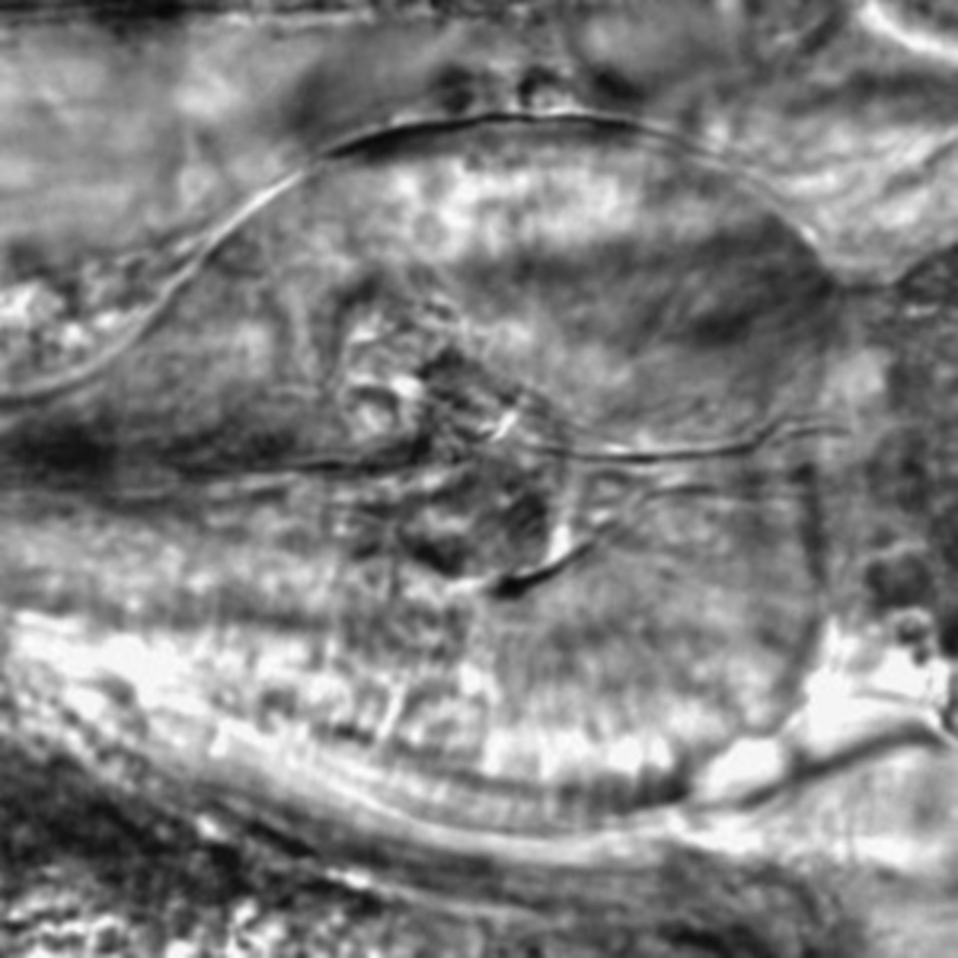 Caenorhabditis elegans - CIL:2771
