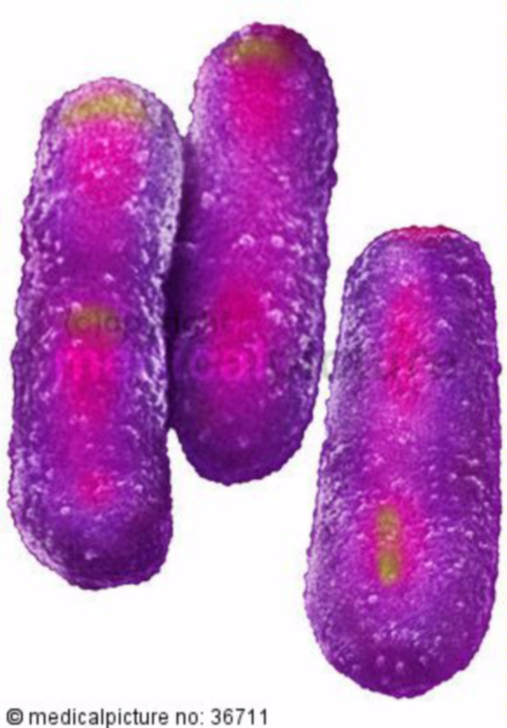  Mycobacterium tuberculosis, Tuberkelbakterie 
