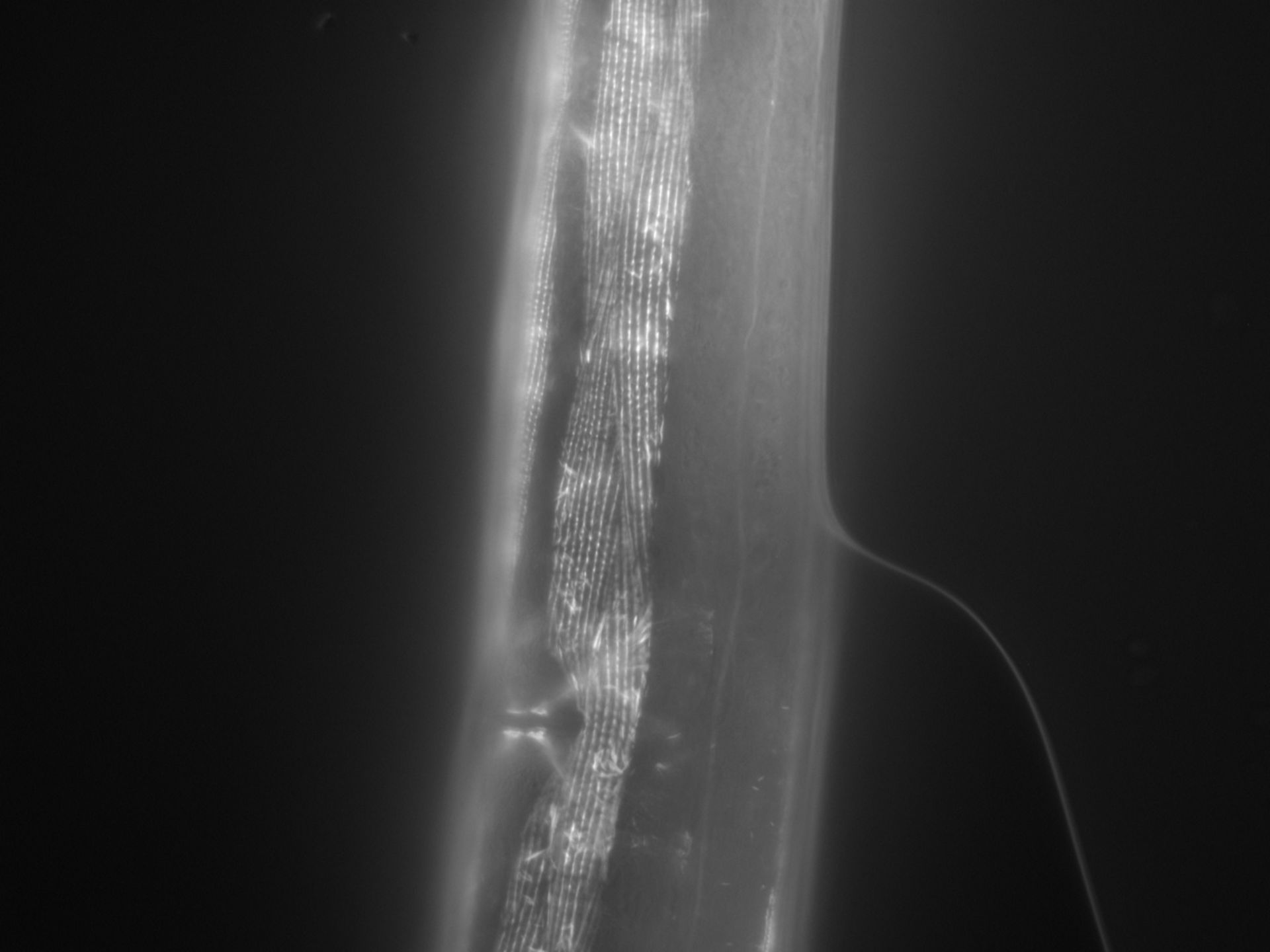 Caenorhabditis elegans (Actin filament) - CIL:1028