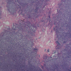 Ligase DocCheck Flexikon