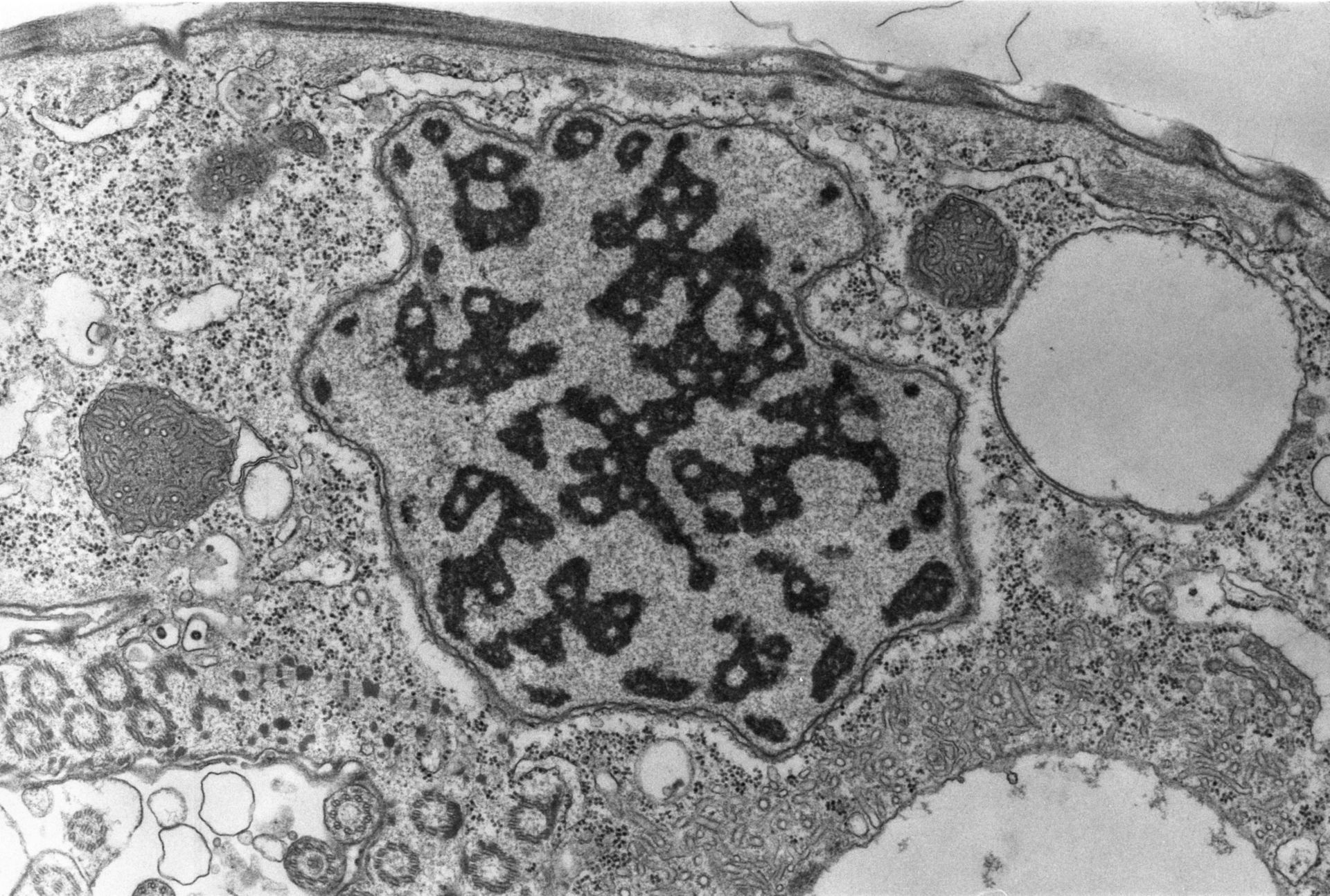 Opercularia coarctata (Micronucleus) - CIL:7305