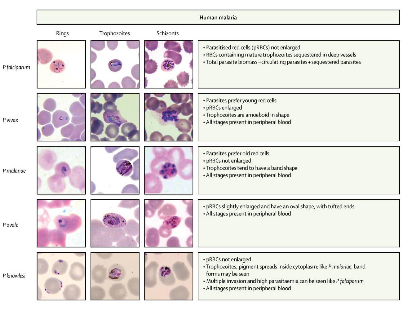 doccheck_-_09_malaria_-_02_mikroskopie_original.jpg