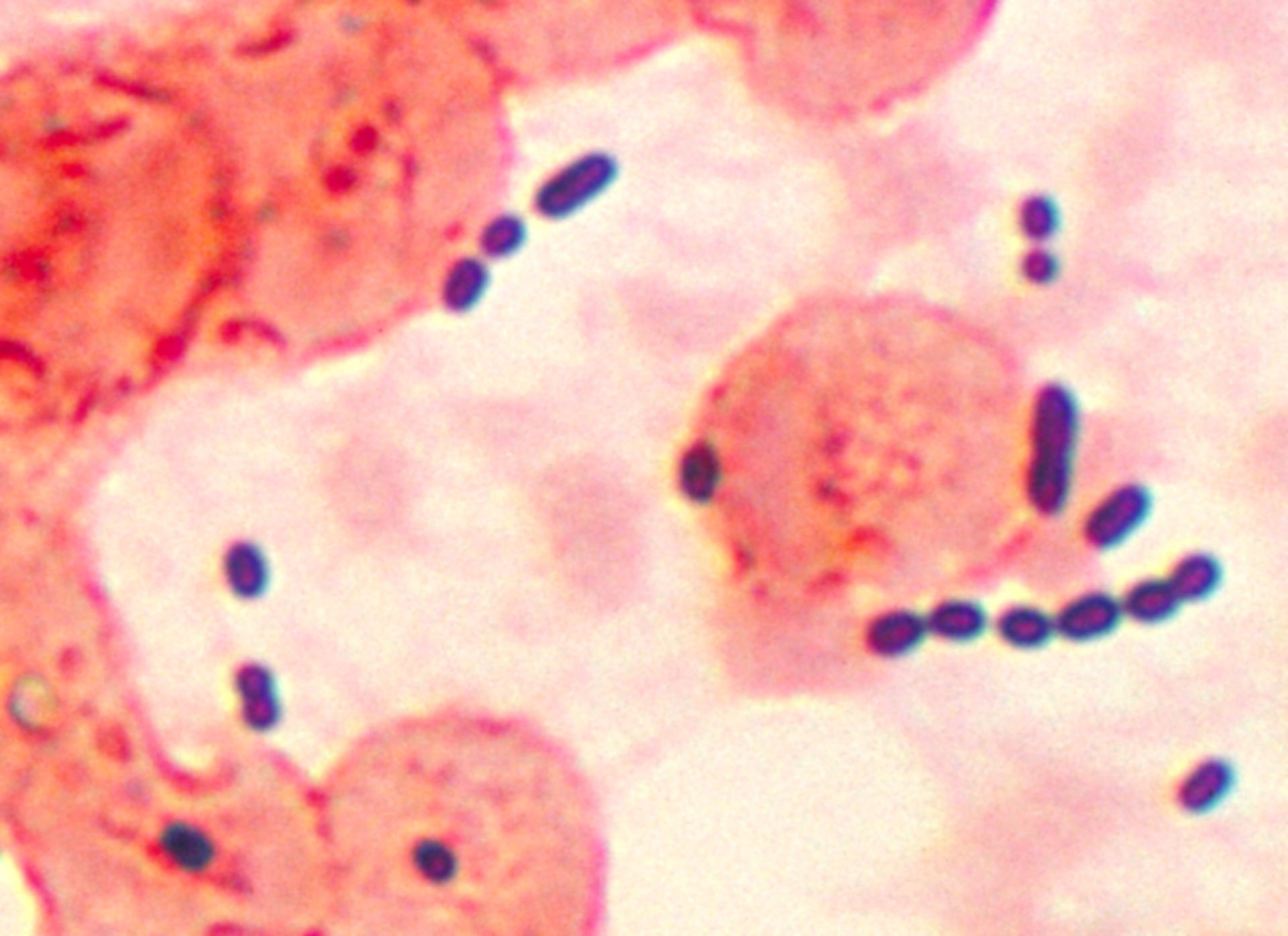 Enterococcus (Gramfärbung)