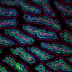 Fluoreszenzmikroskopie - DocCheck Flexikon