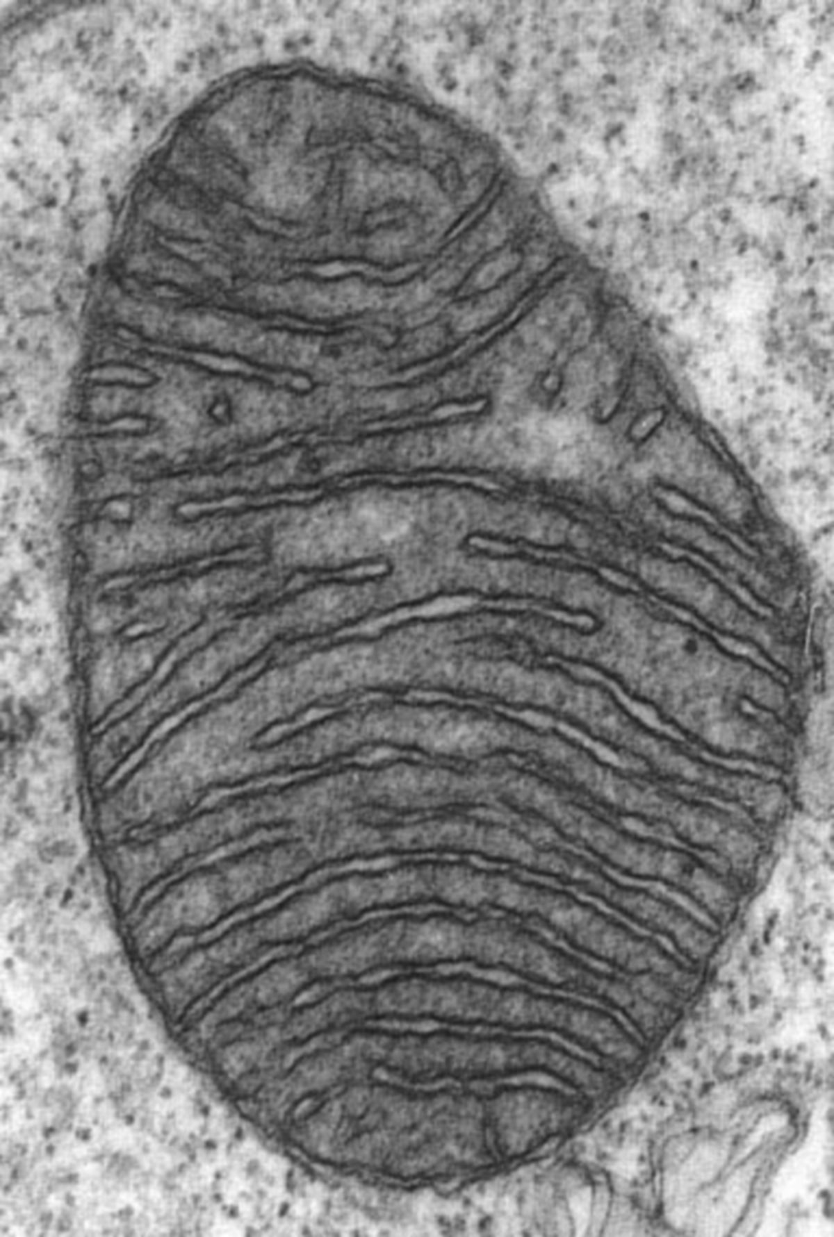 Ultrastruktur Mitochondrium