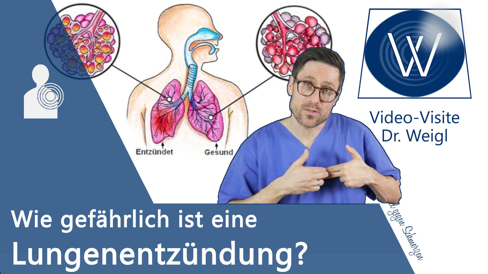 Lungenentzündung: Wie gefährlich ist die Pneumonie? Hygiene & Prophylaxe sowie Symptome & Therapie