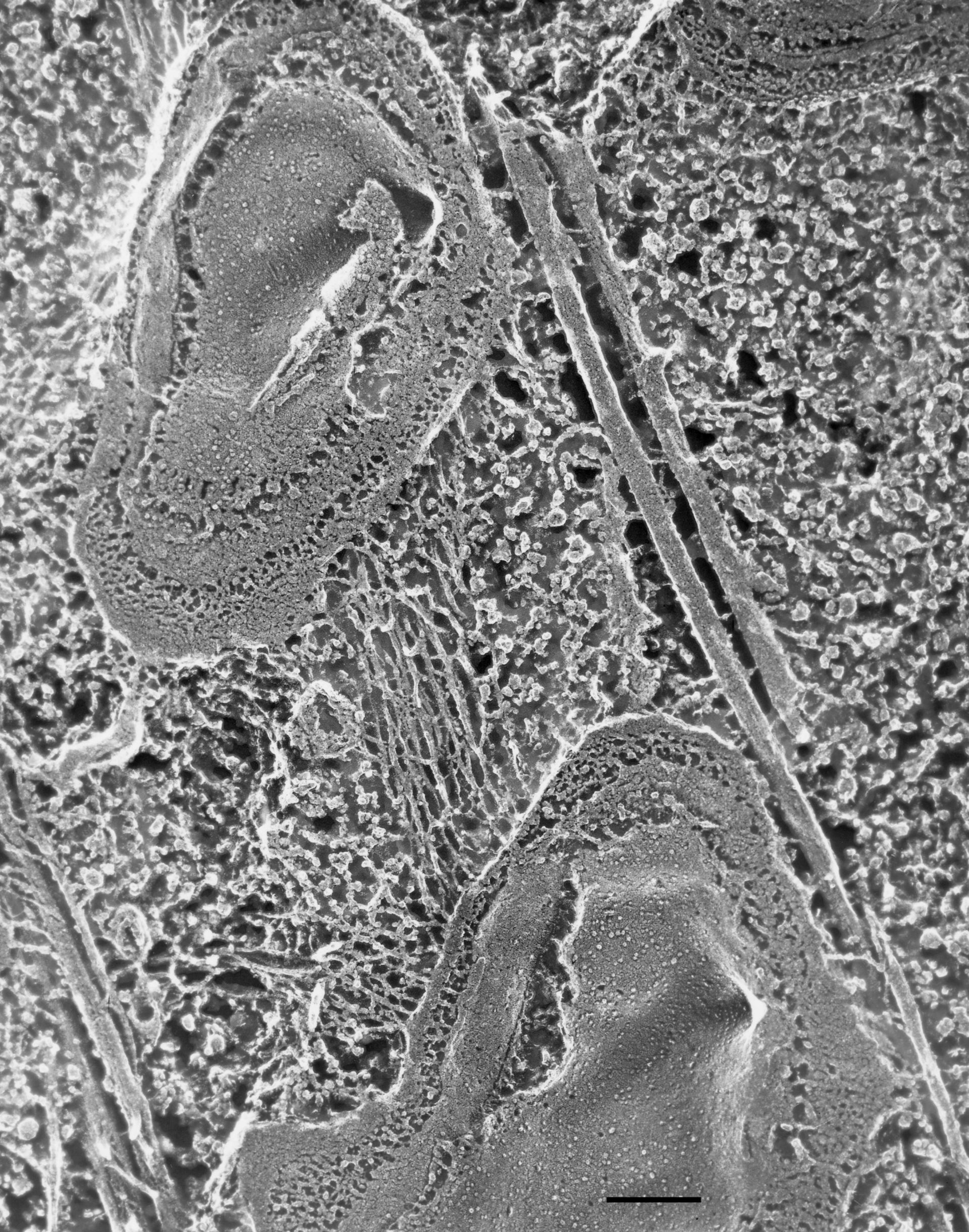 Paramecium multimicronucleatum (Cell cortex) - CIL:36616