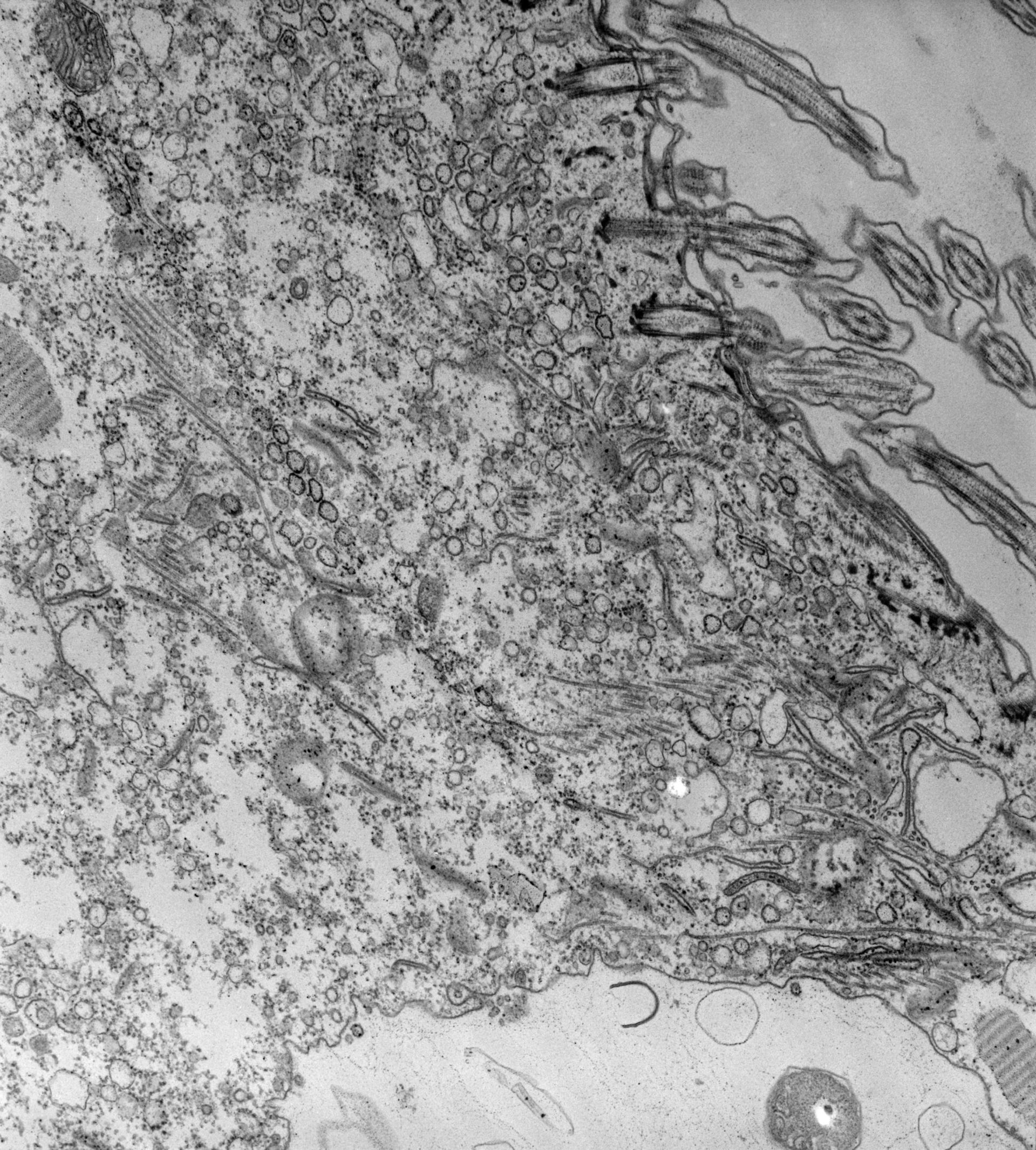 Paramecium caudatum (Carrier vesicles) - CIL:39179