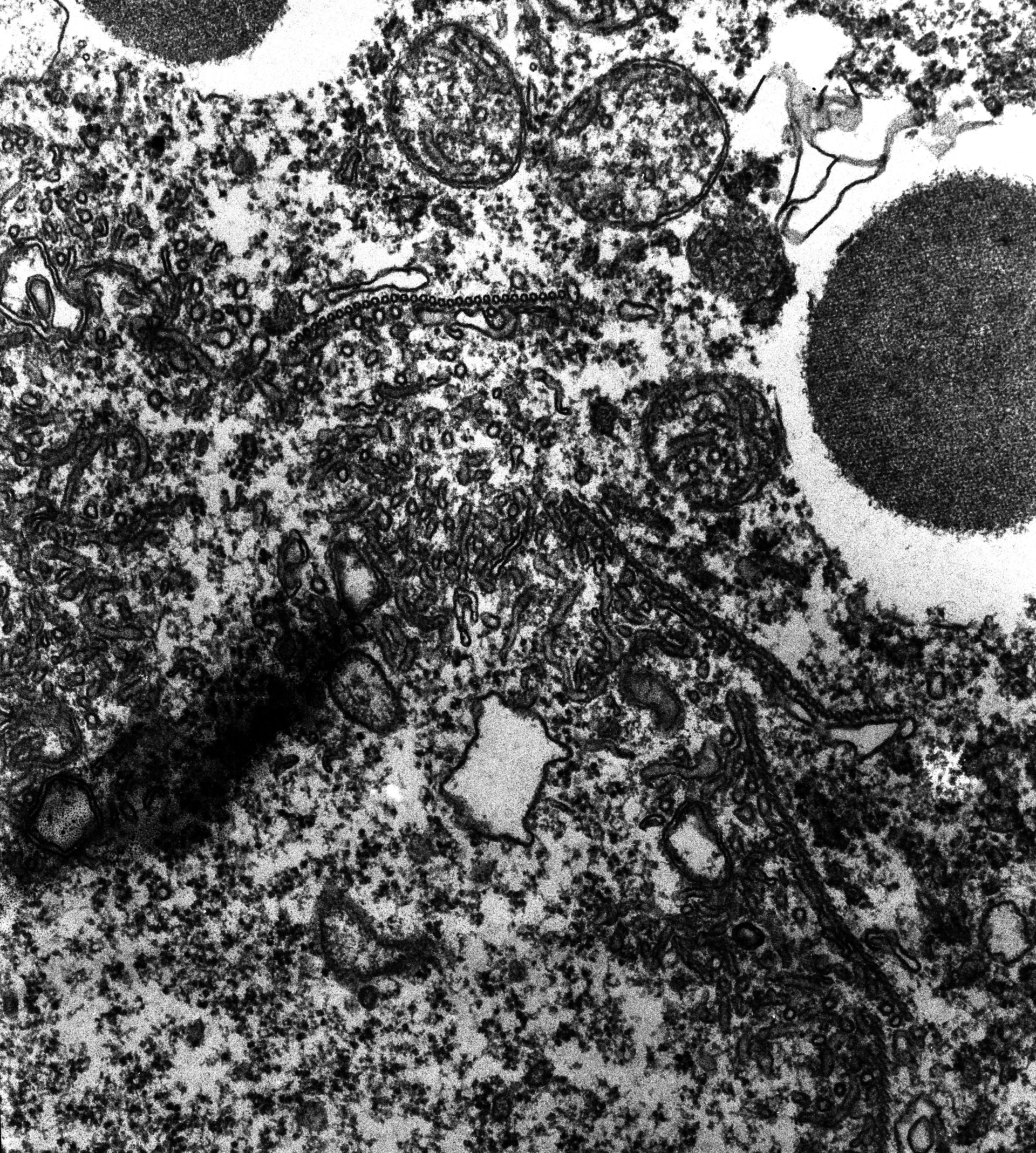 Paramecium multimicronucleatum (Membrane tubules) - CIL:12996