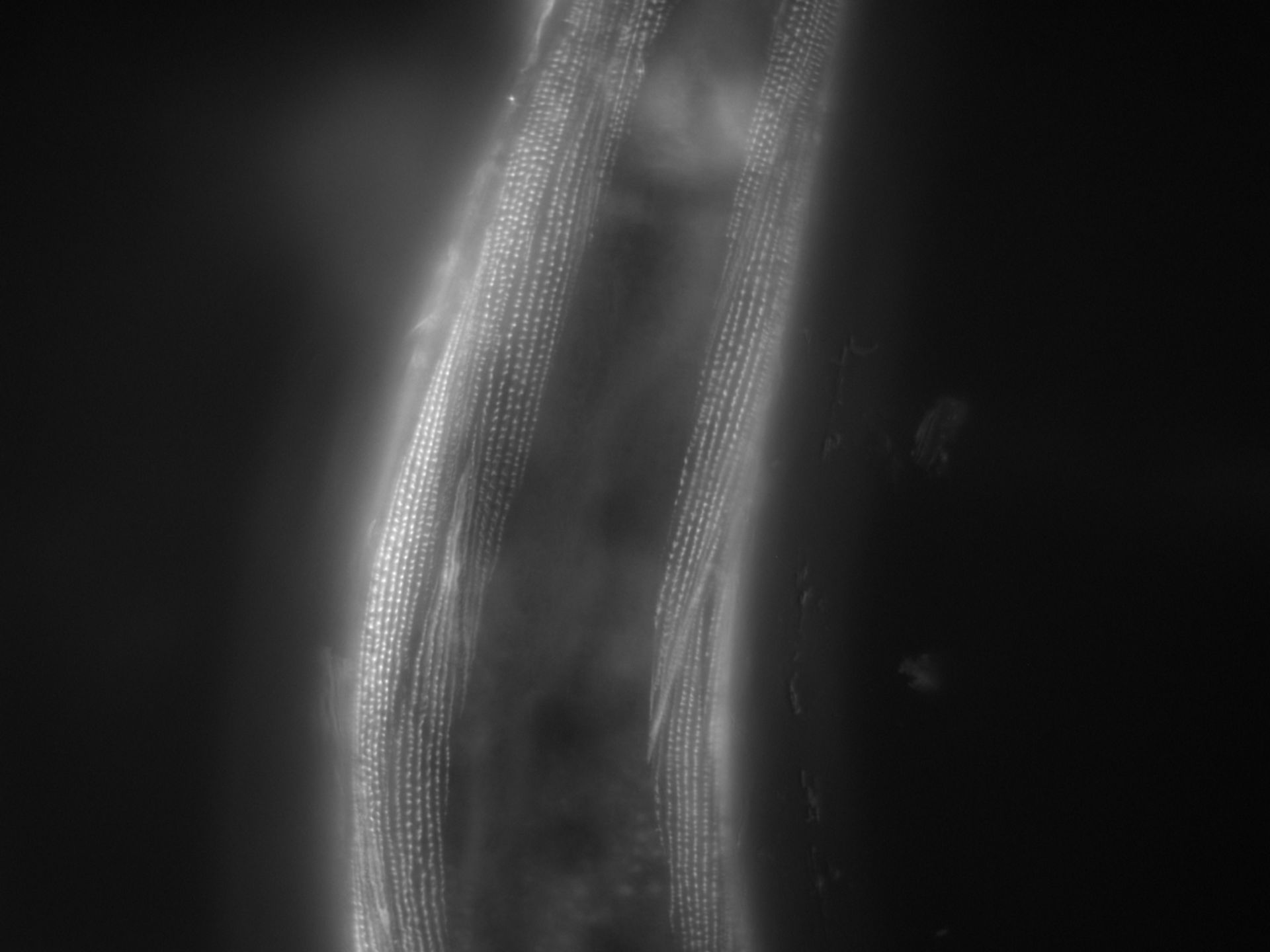 Caenorhabditis elegans (Actin filament) - CIL:1166