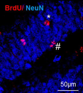 Probiotika und Lauftraining stimulieren die Bildung von neuen Nervenzellen (rot).