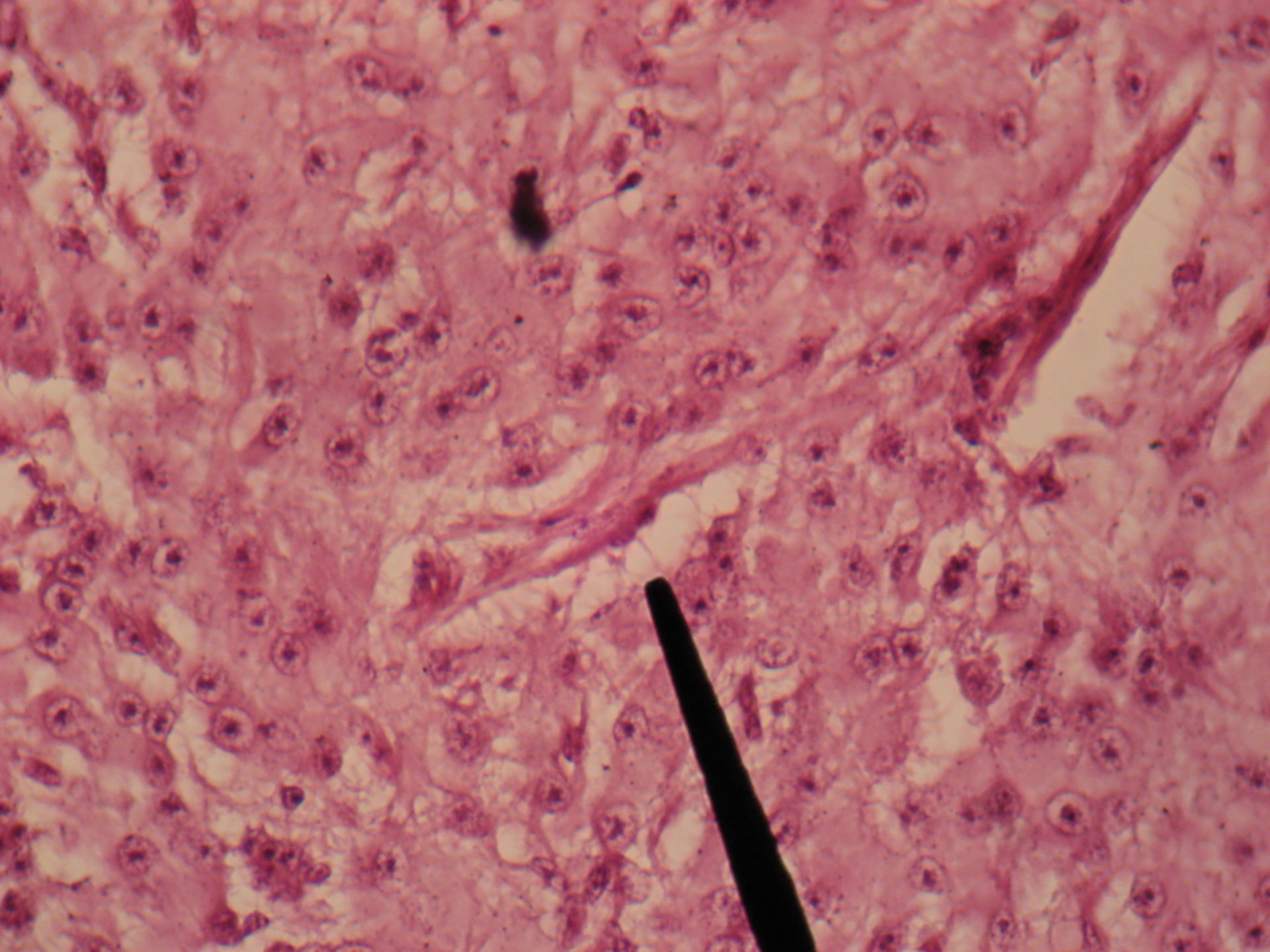 Epiphyse des Kalb - Kapillare   Pinealozyten