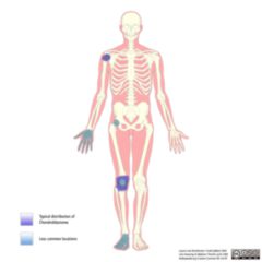 Spongiosa DocCheck Flexikon