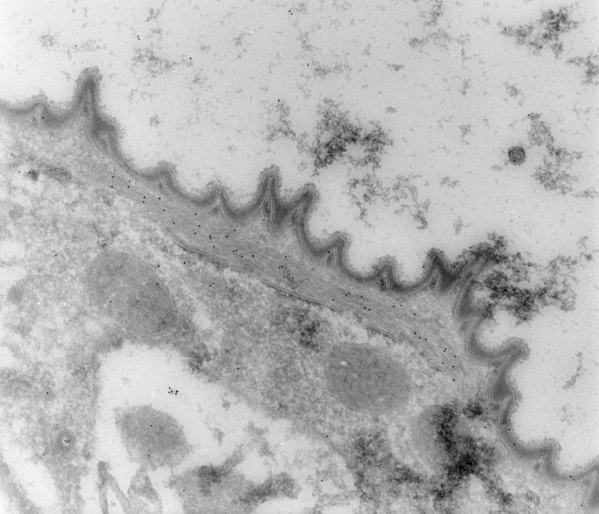 Vorticella convallaria (Myofibril) - CIL:39513