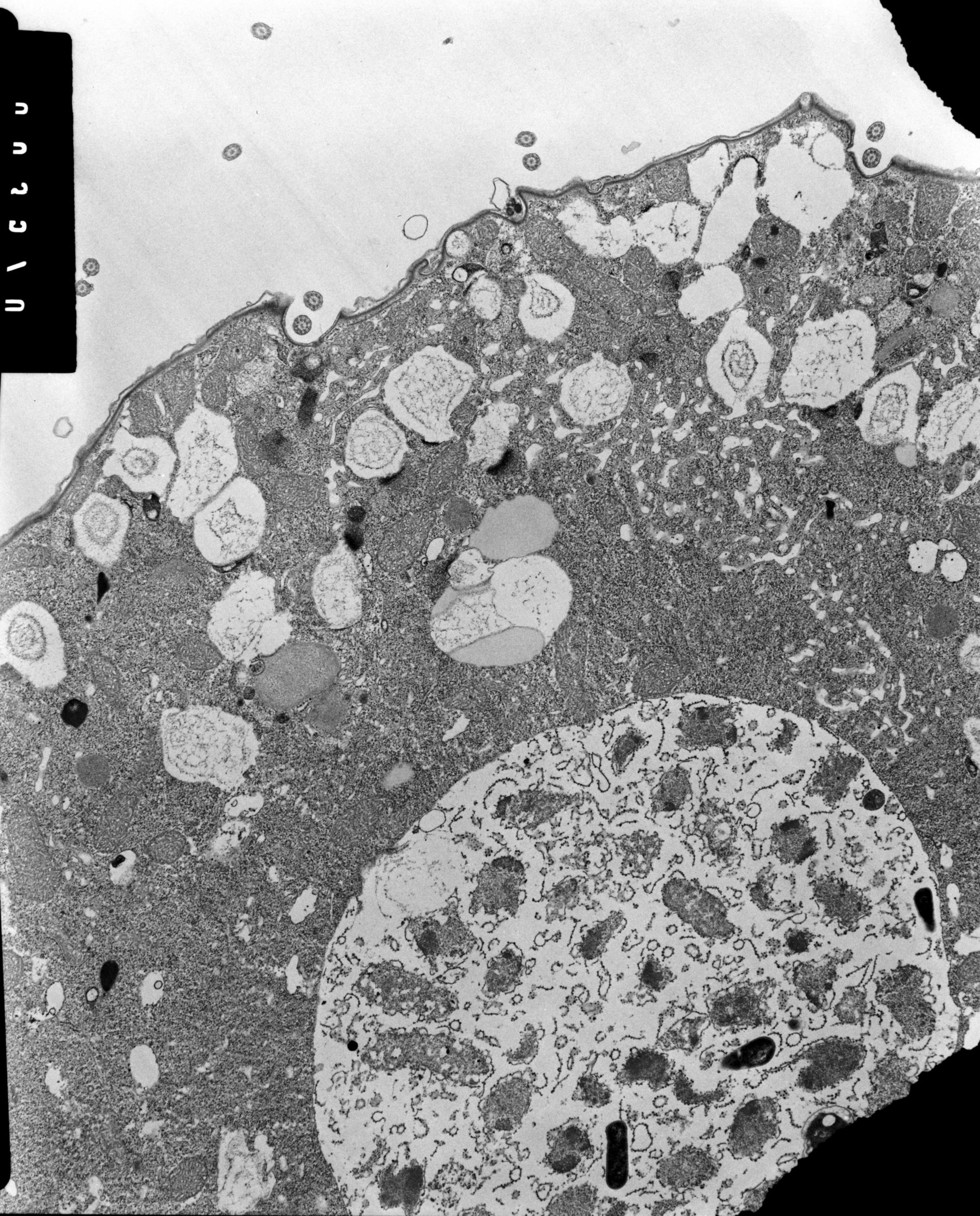 Colpoda cucullus (Dikinetid) - CIL:38831