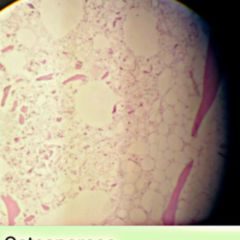 alternative steroide - Was tun bei Ablehnung