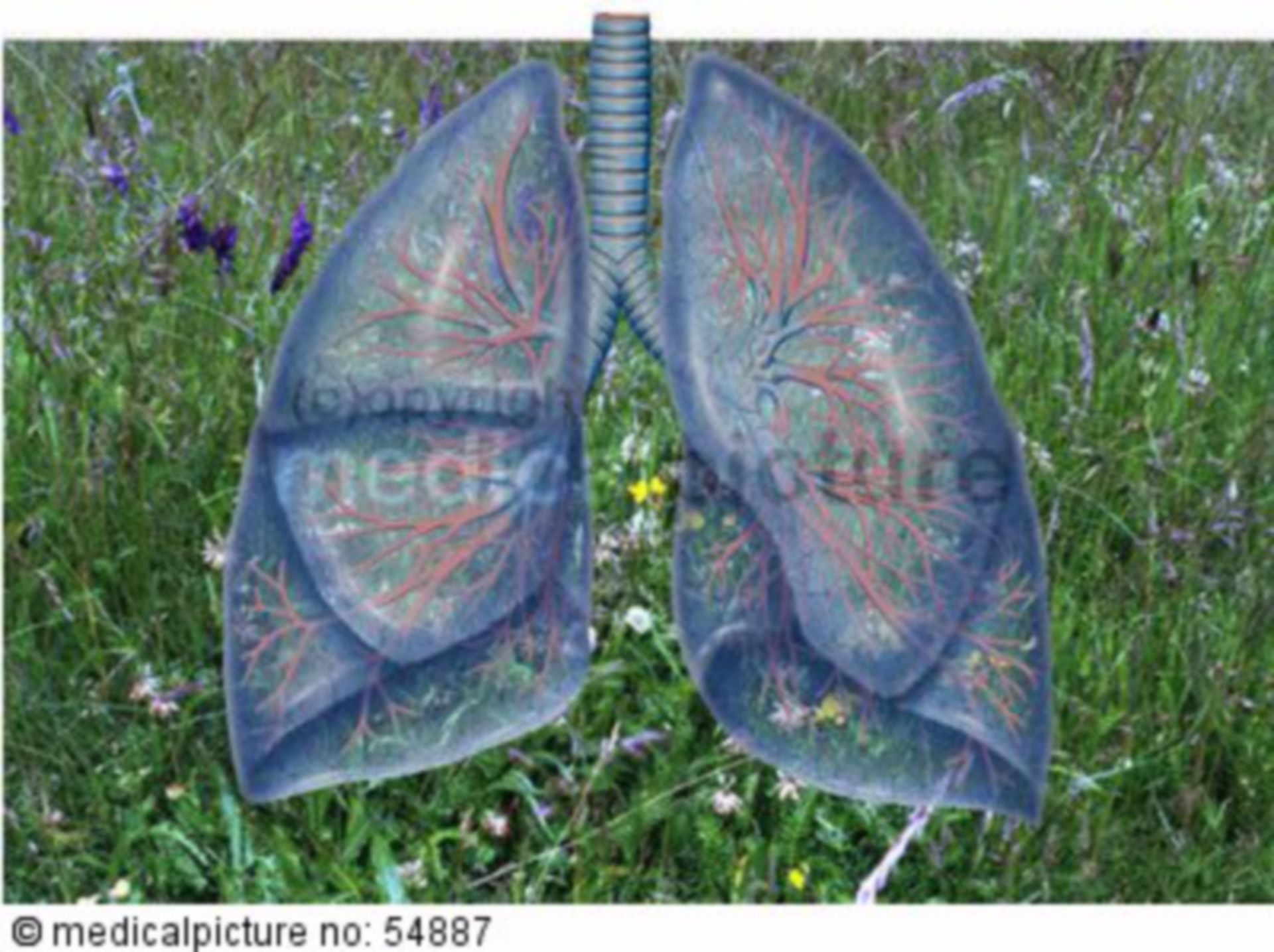Allergic lung diseases