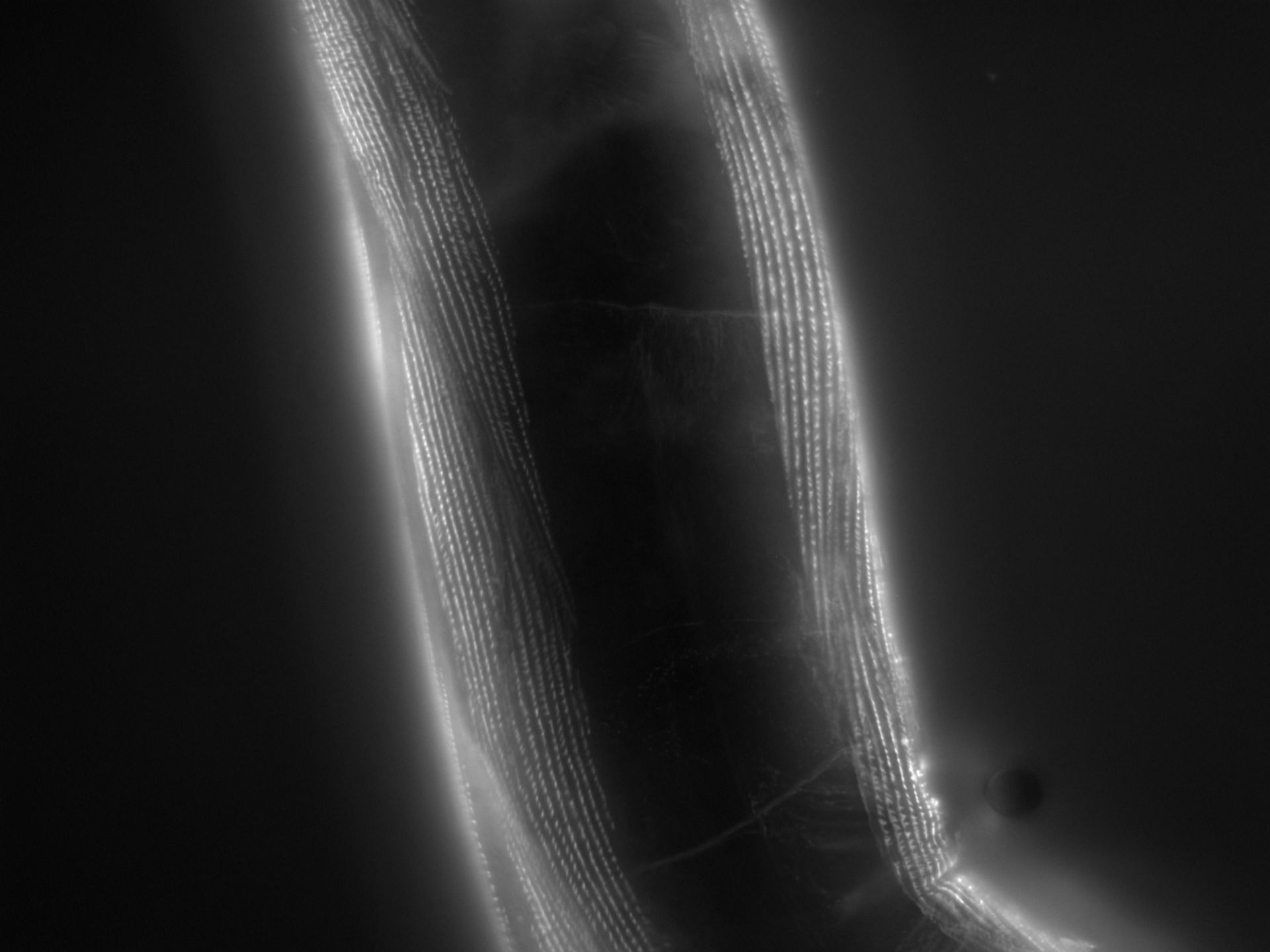 Caenorhabditis elegans (Actin filament) - CIL:1181