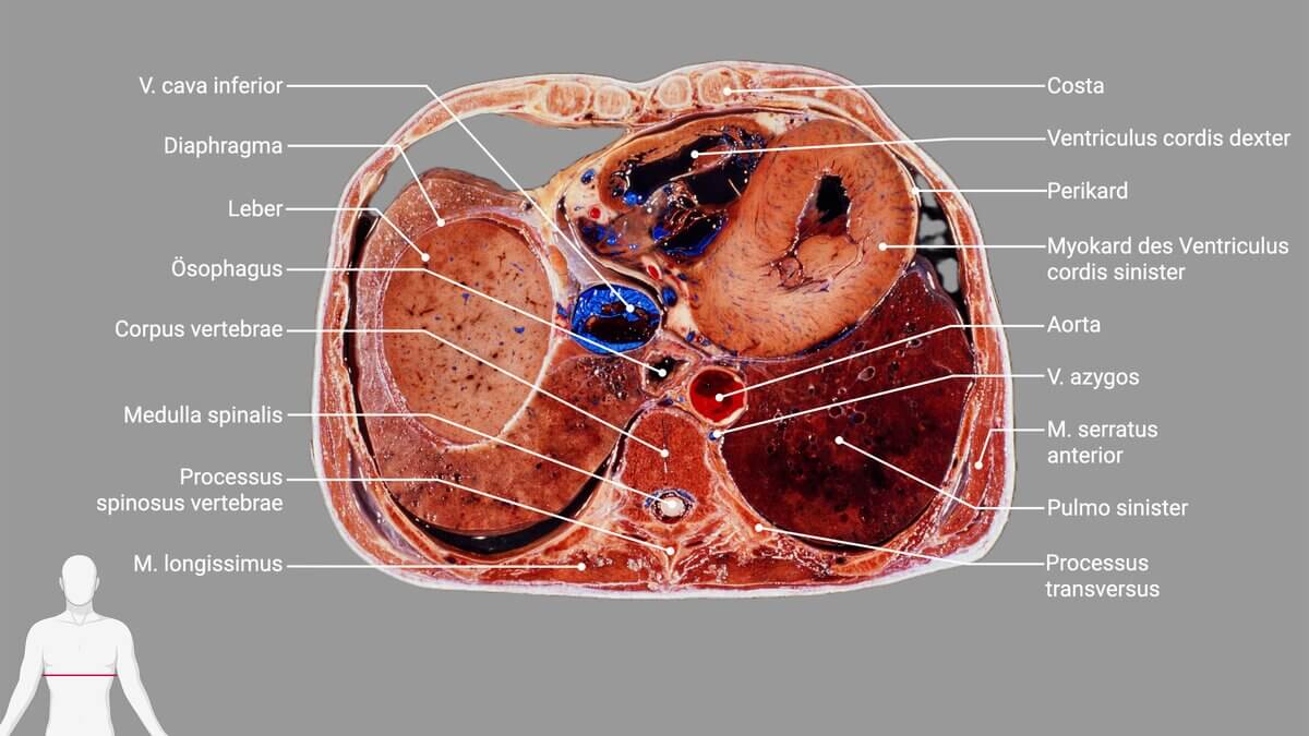 Schnittbildpräparat Thorax