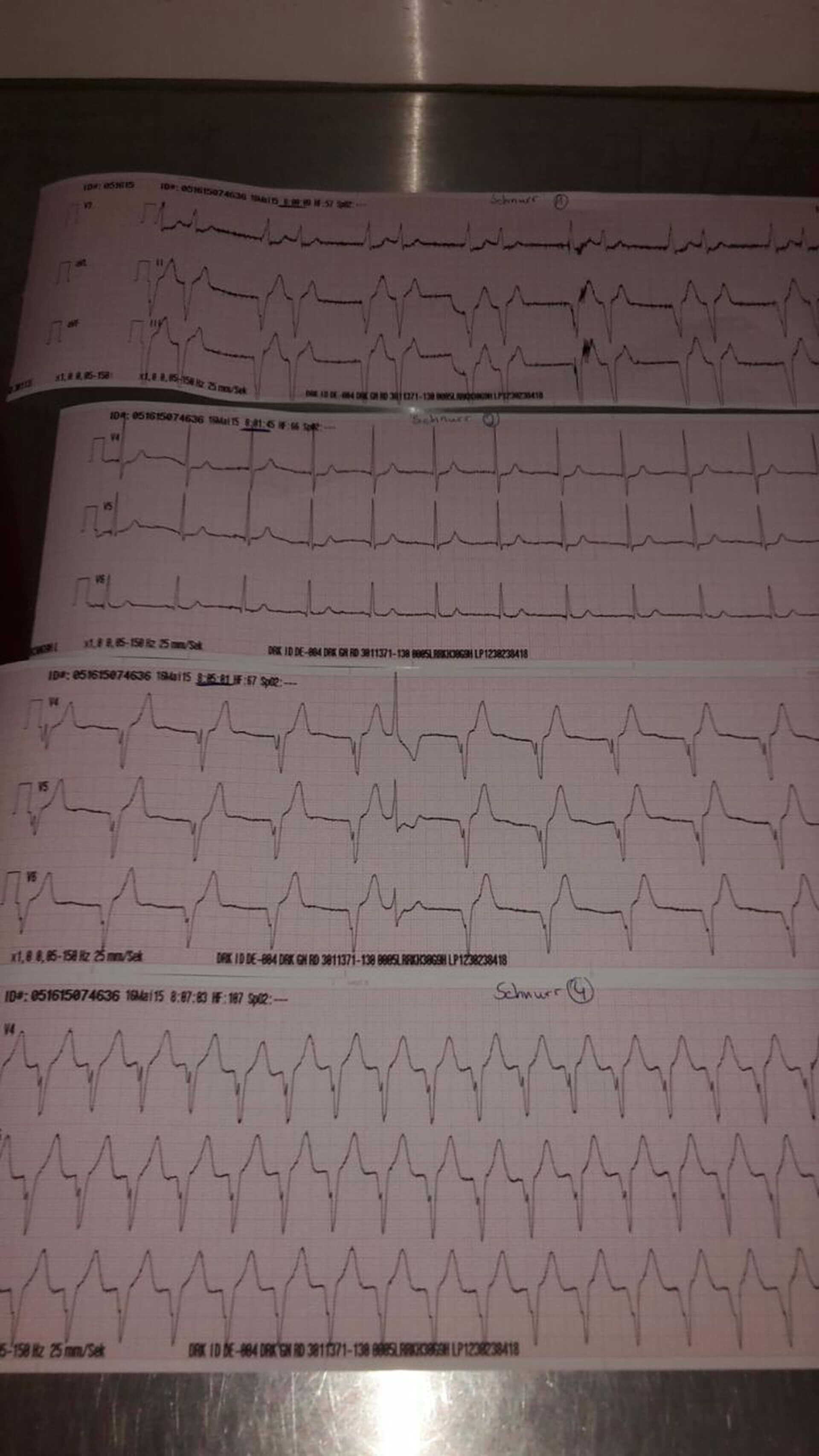 Intermittierender AIVR