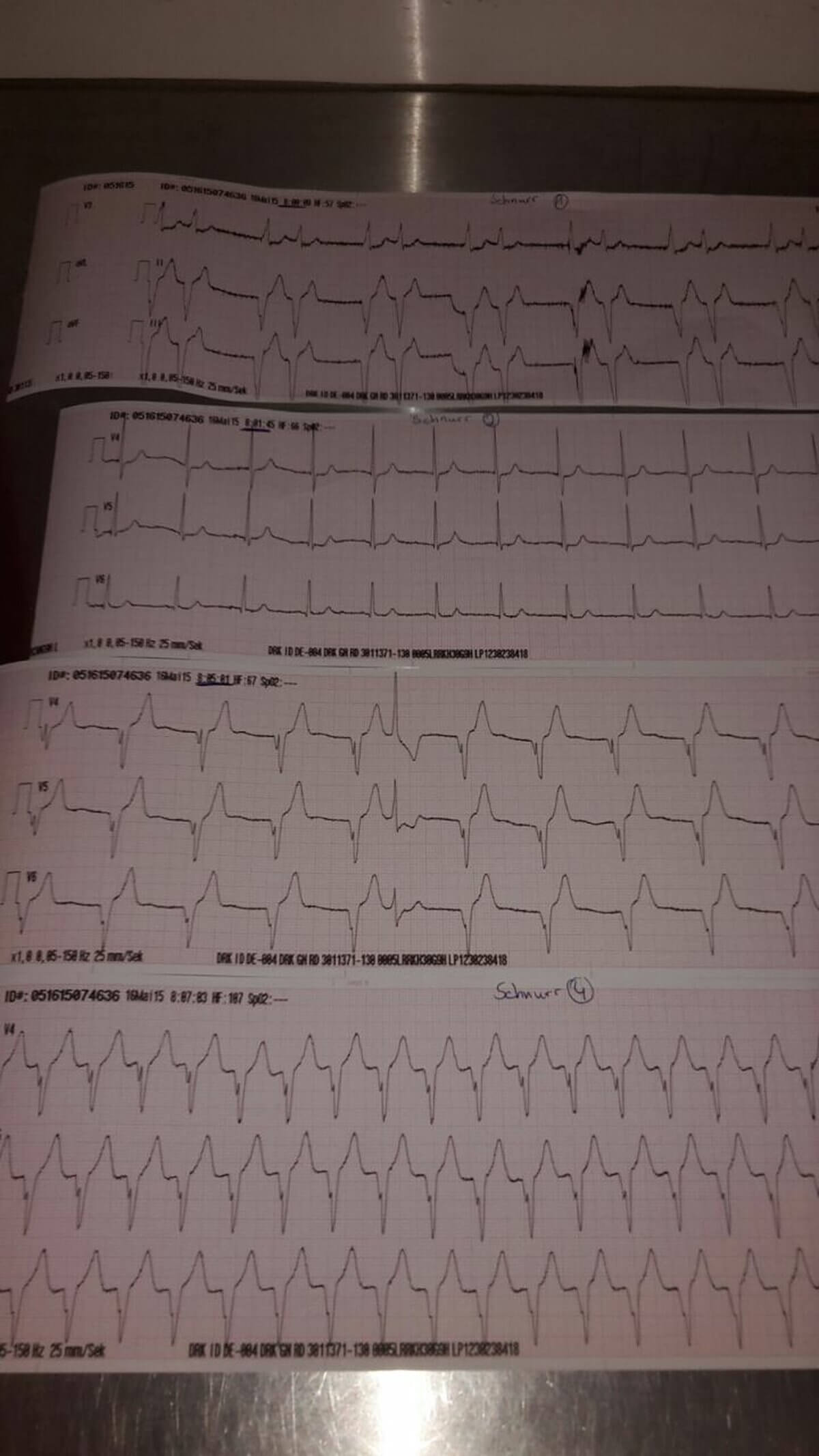 Intermittierender AIVR