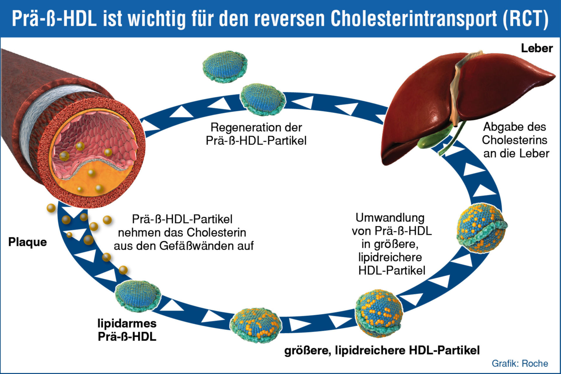Prä-ß-HDL ist wichtig für den reversen Cholesterintransport (RCT)