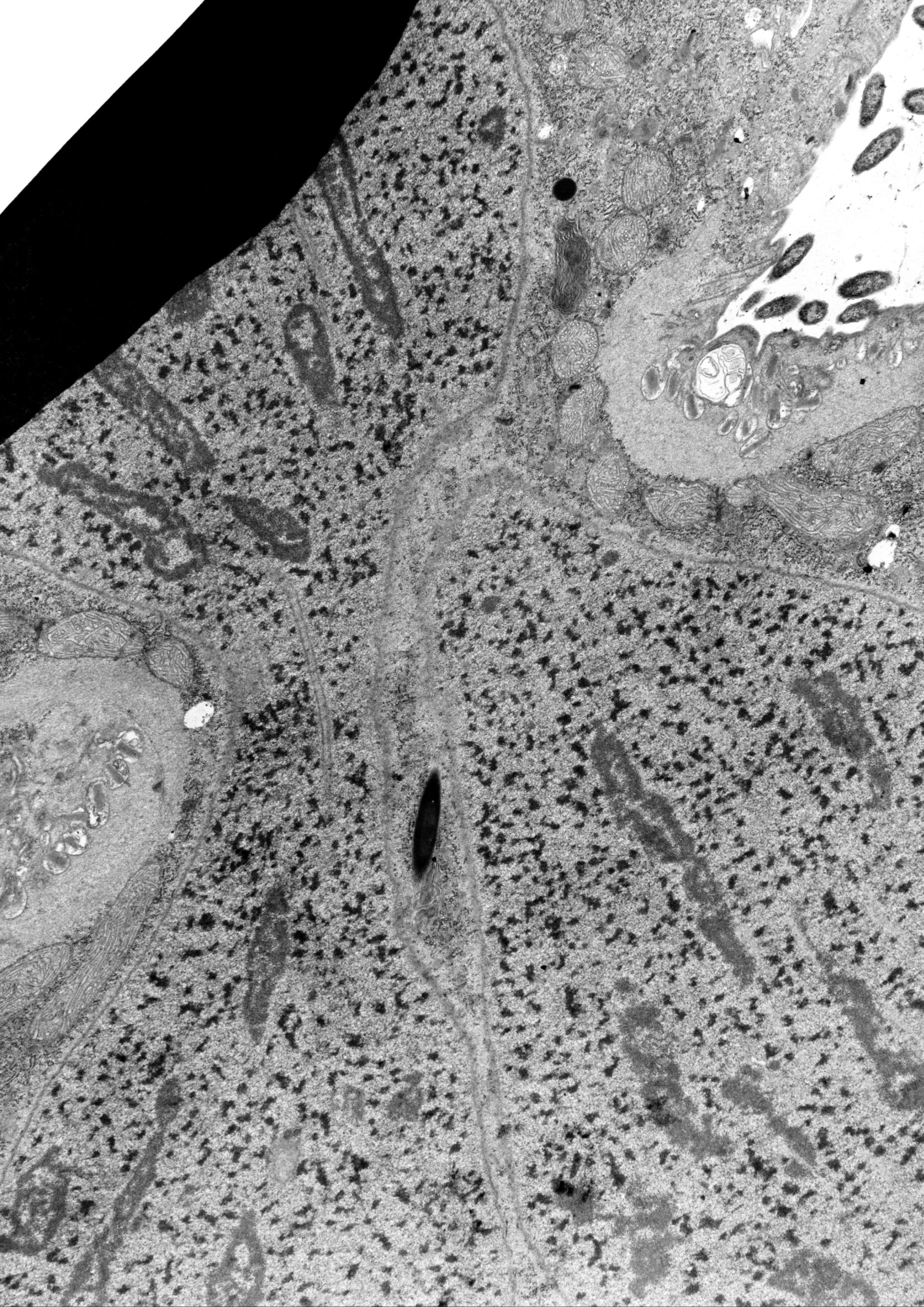 Didinium nasutum (cromatina nucleare) - CIL:38865