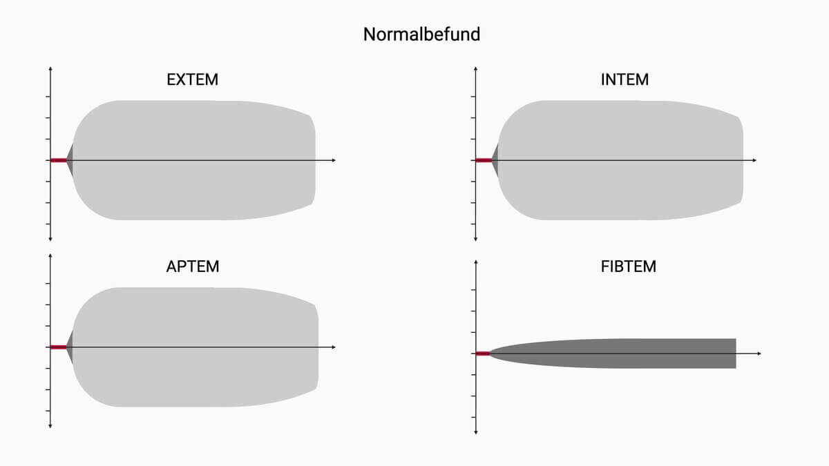 Rotationsthrombelastometrie (ROTEM®)