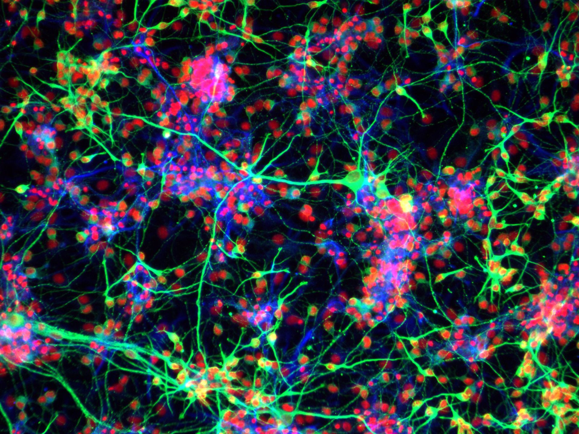 Neurale Stammzellen