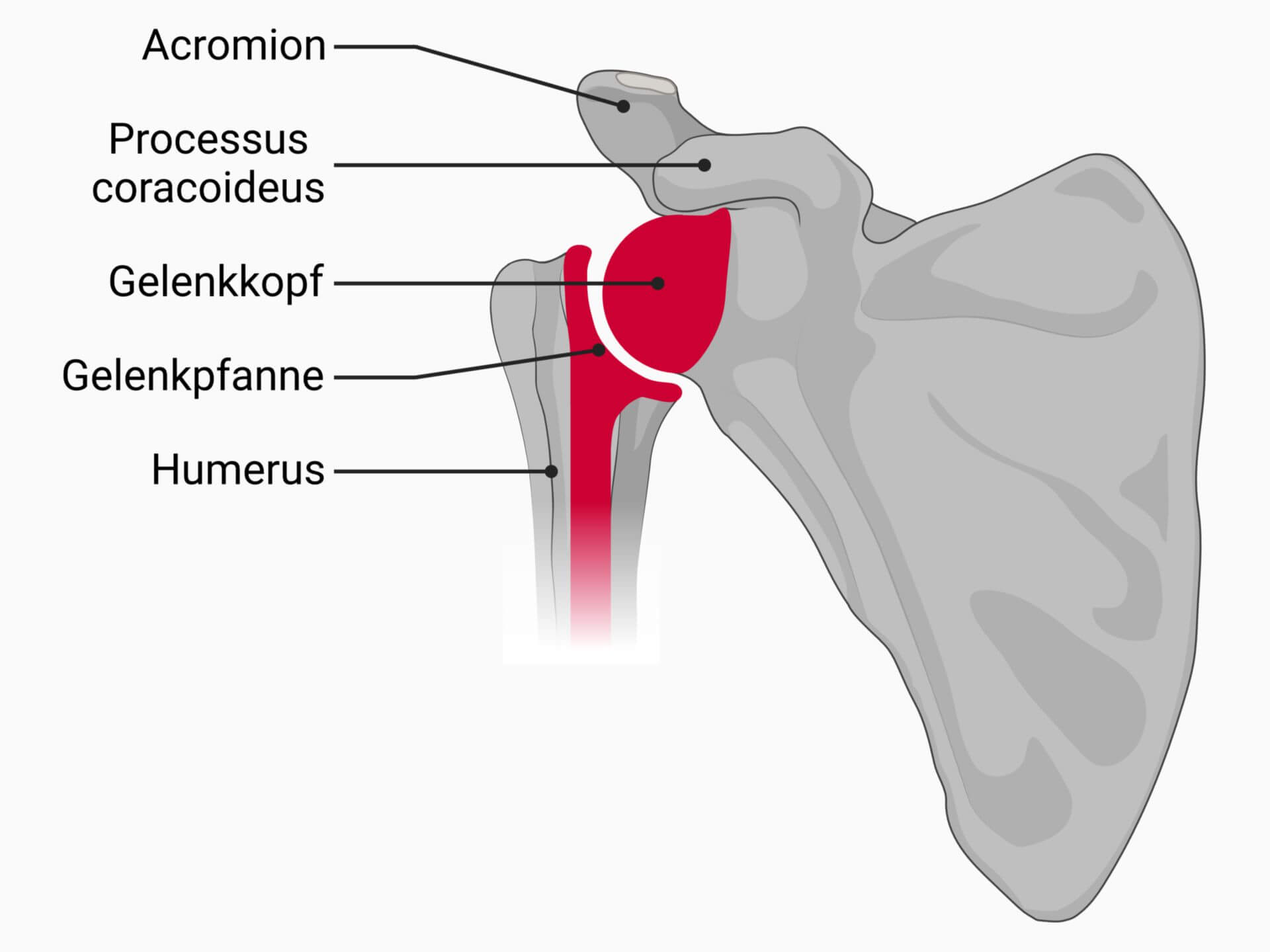 Inverse Schulterprothese