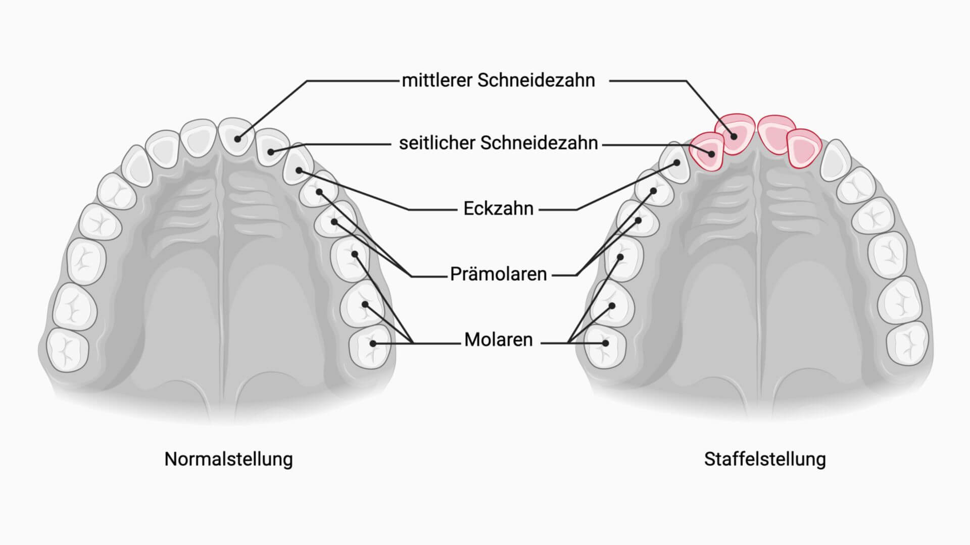 Staffelstellung