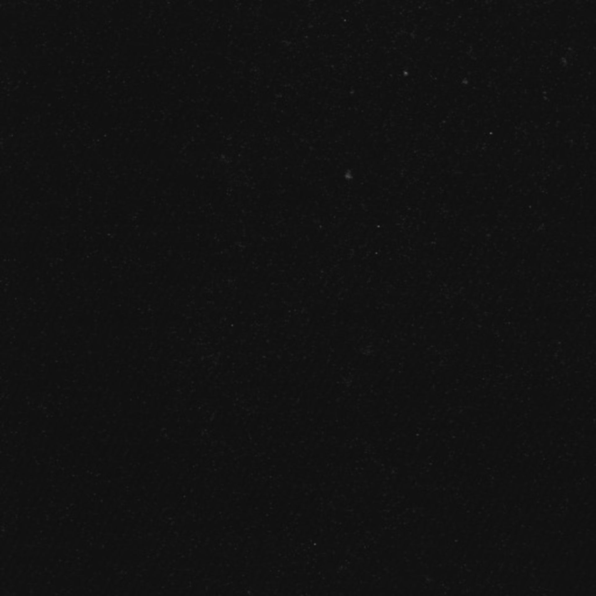 Xenopus laevis (Neuronal cell body) - CIL:37017