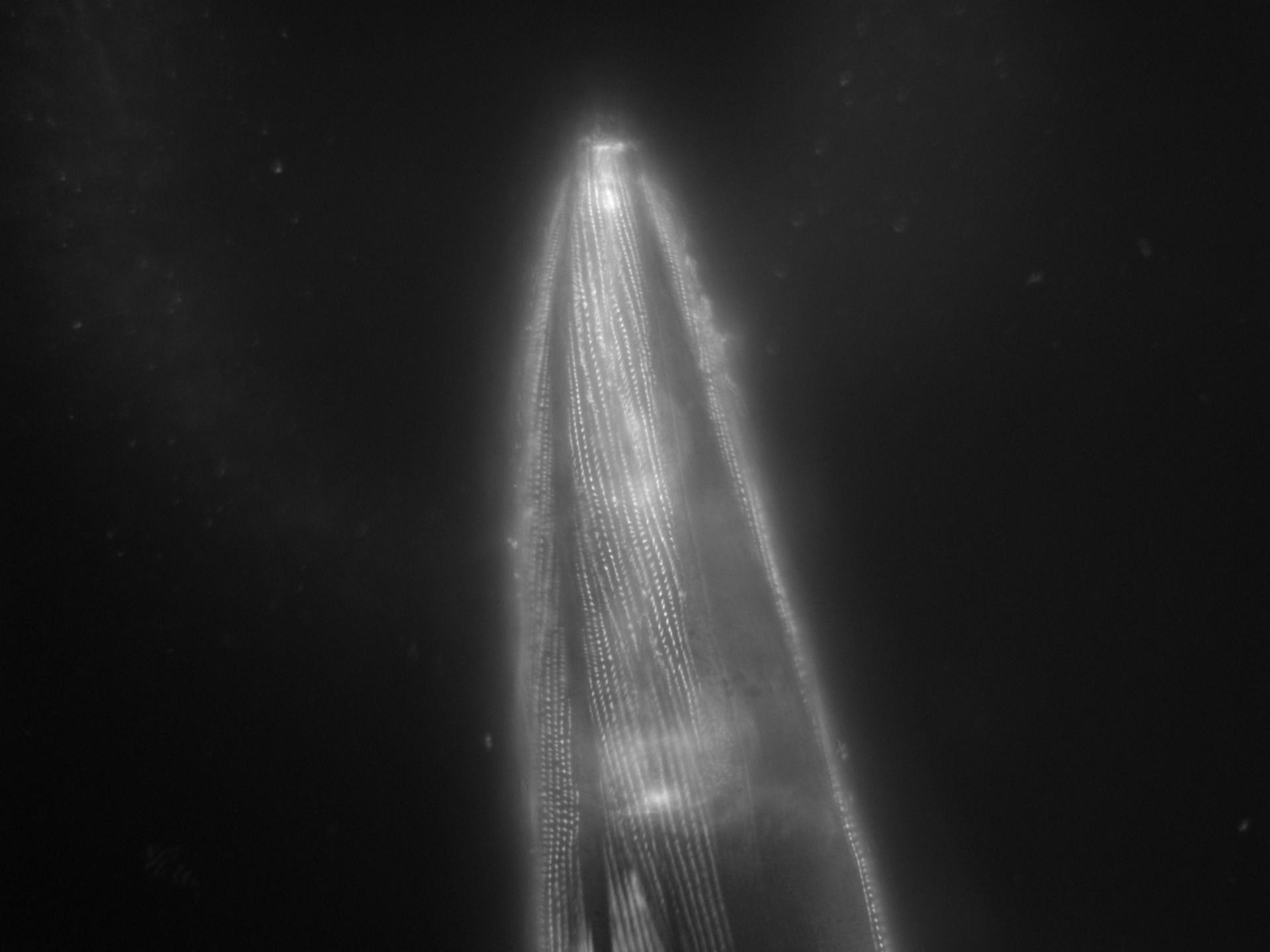 Caenorhabditis elegans (Actin filament) - CIL:1192