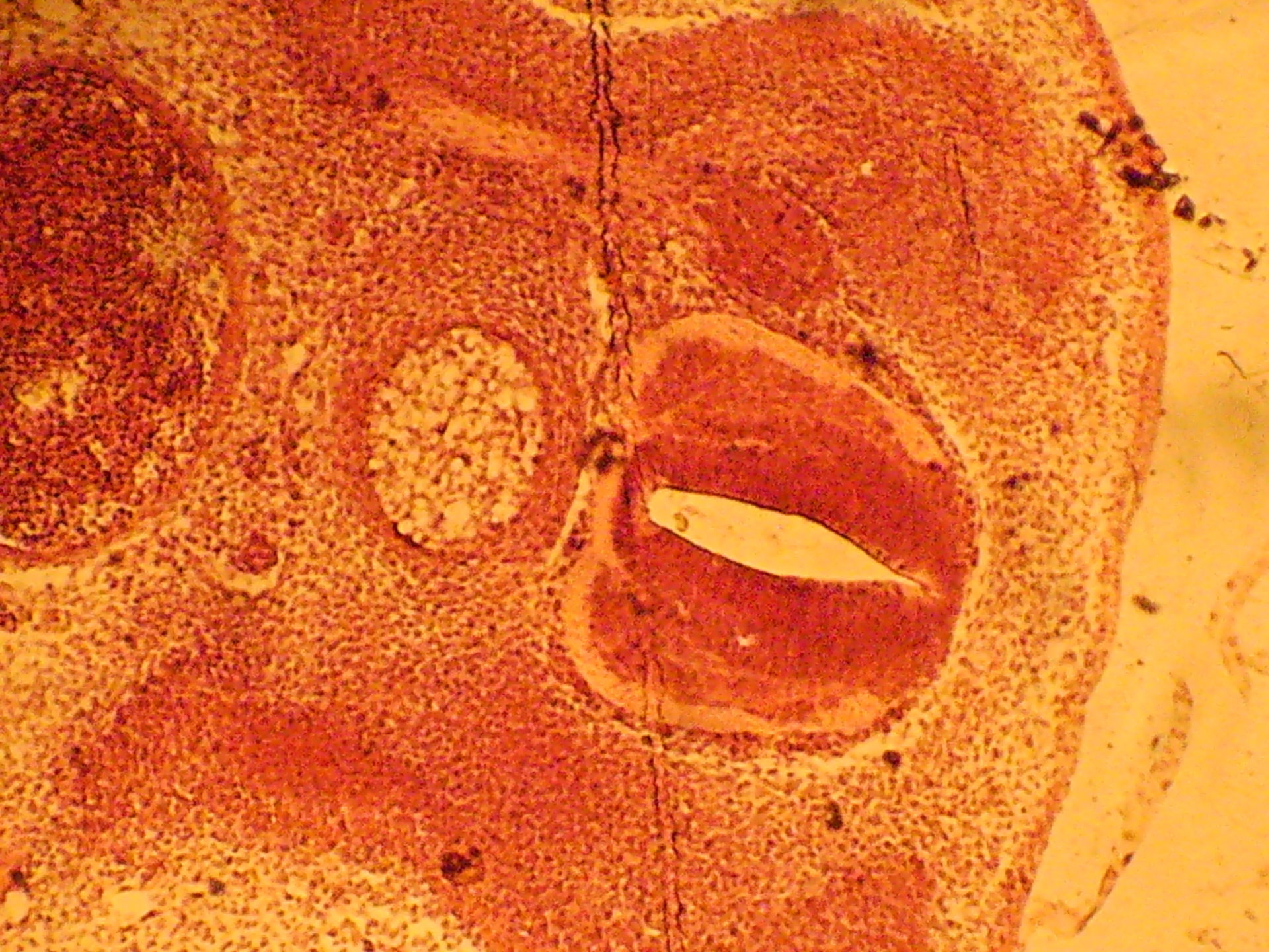 Hühnchenembryo