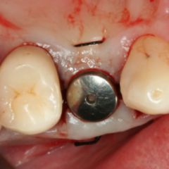 Gingiva DocCheck Flexikon