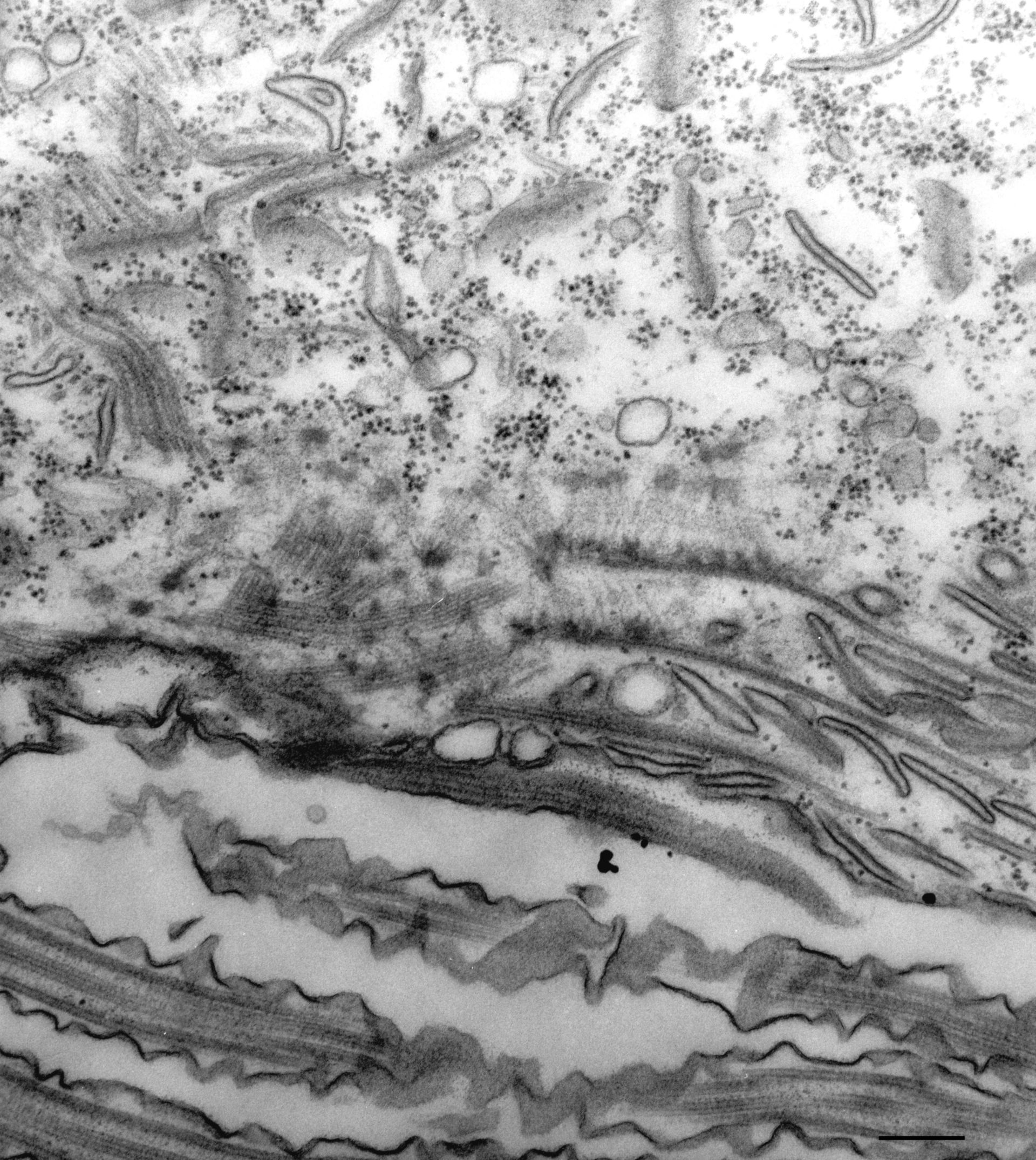 Paramecium multimicronucleatum (Microtubule associated complex) - CIL:36708