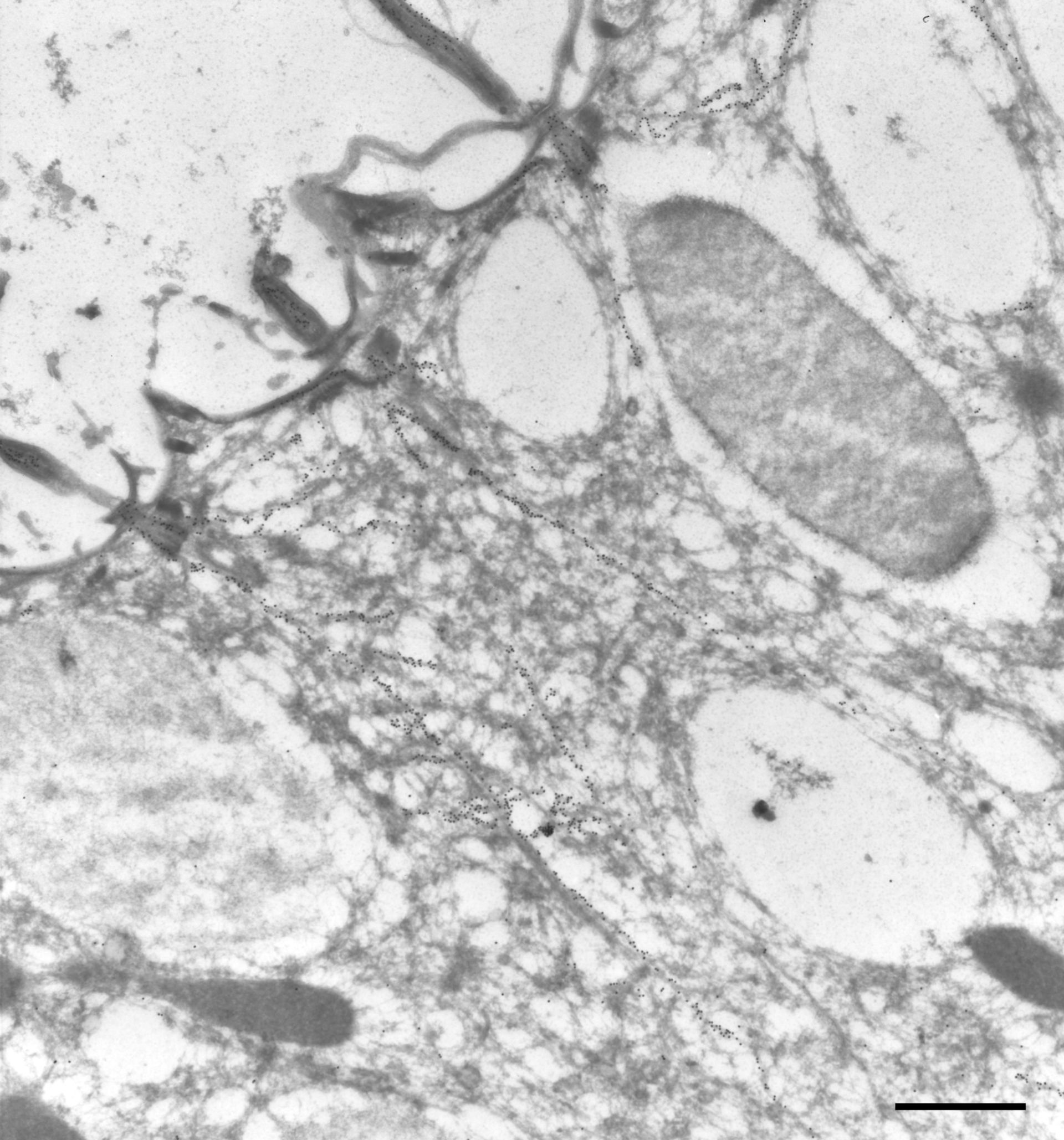 Paramecium tetraurelia (Microtubule basal body) - CIL:9846