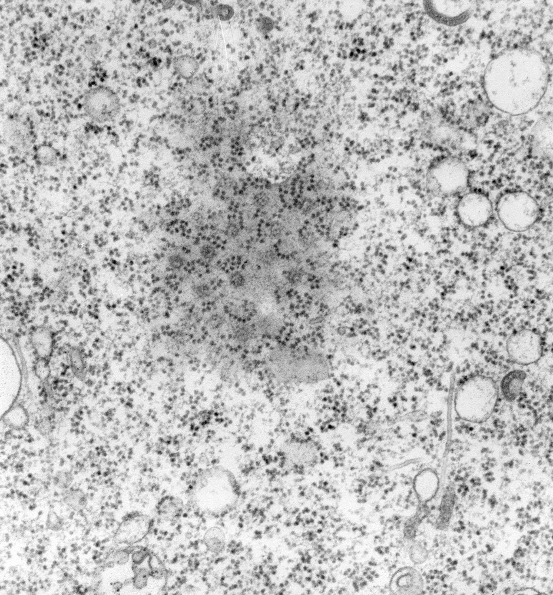 Vorticella convallaria (Nuclear pore) - CIL:39454