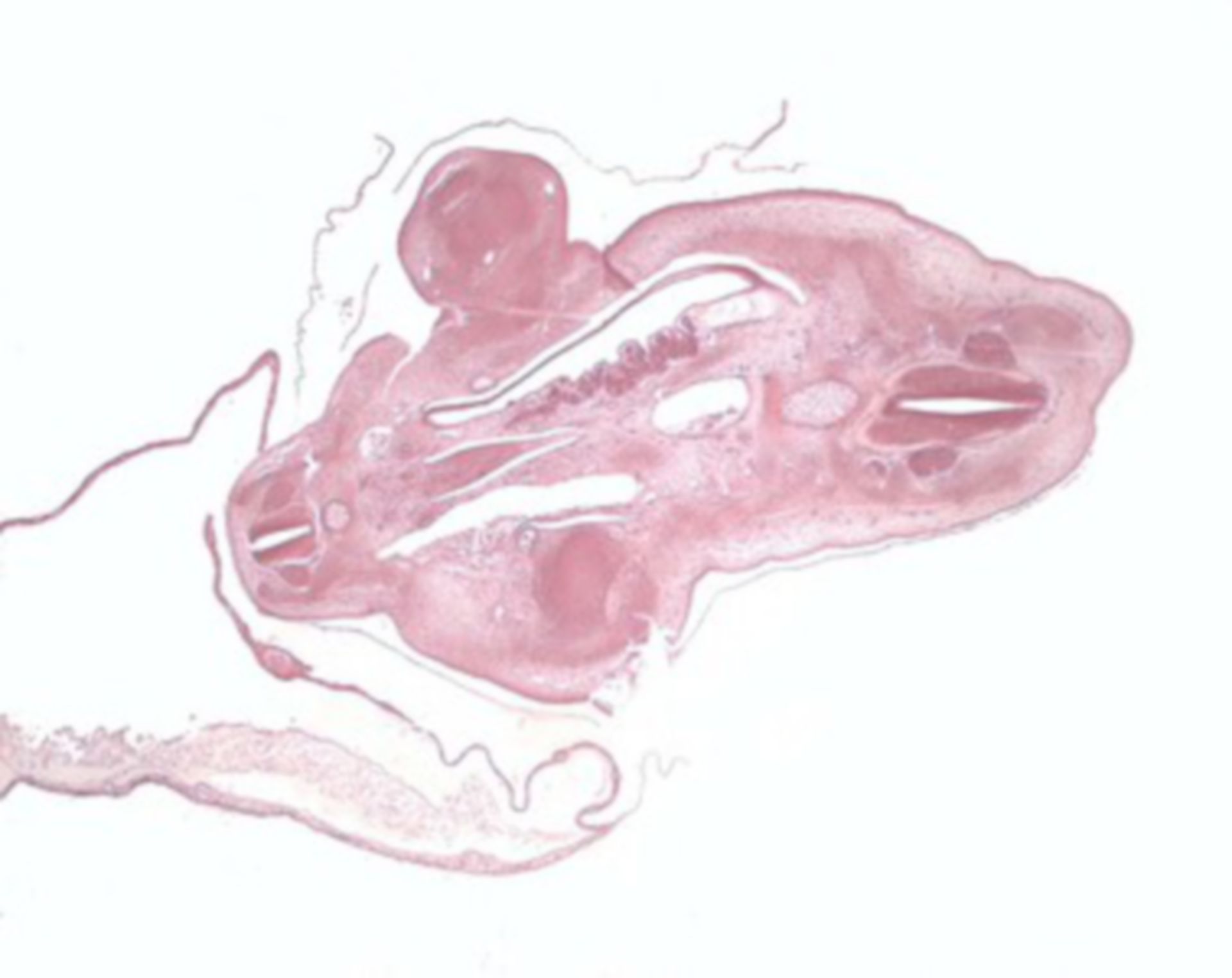 Mesenchymal connective tissue - chicken embryo