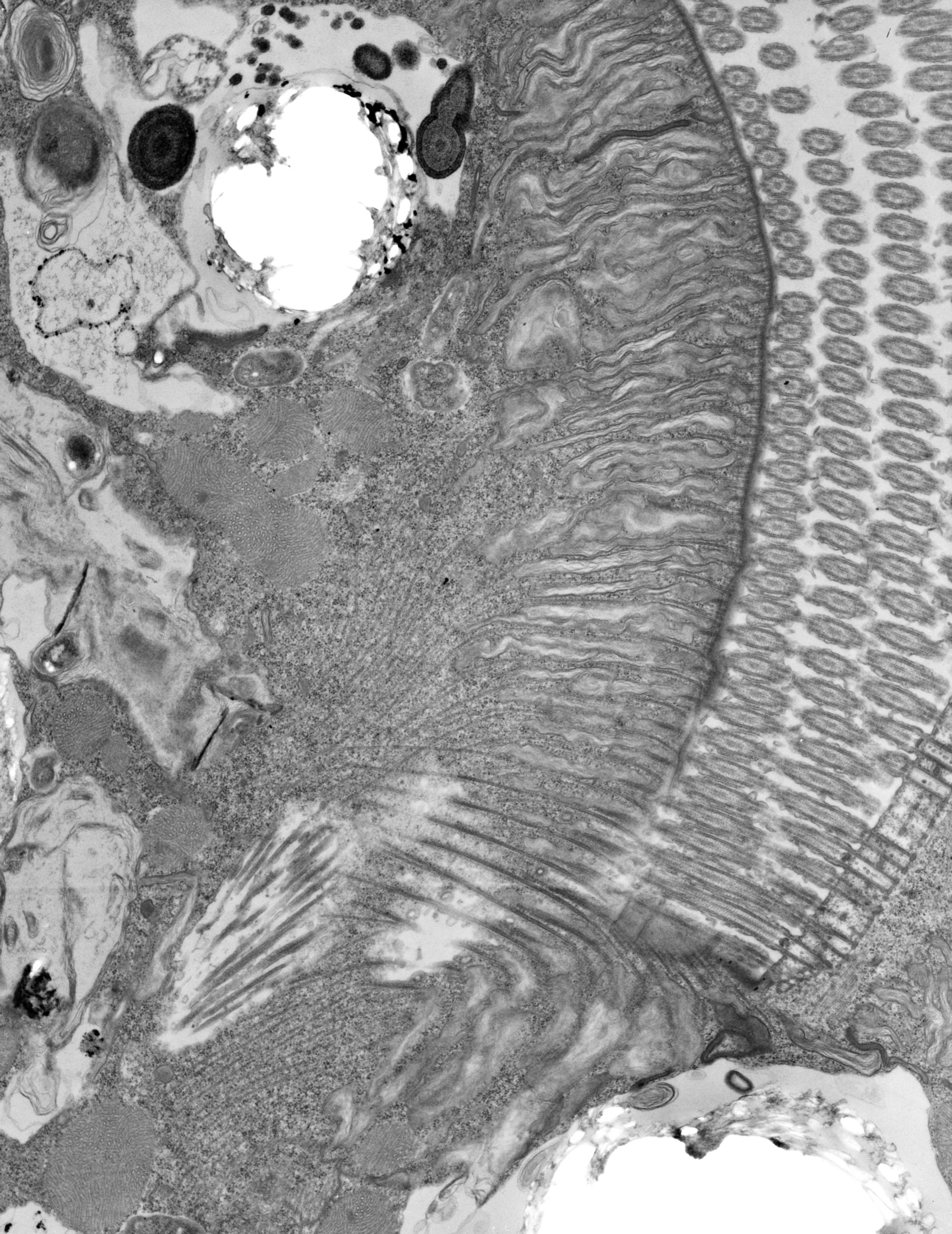 Euplotes sp. (Microfibril) - CIL:39113